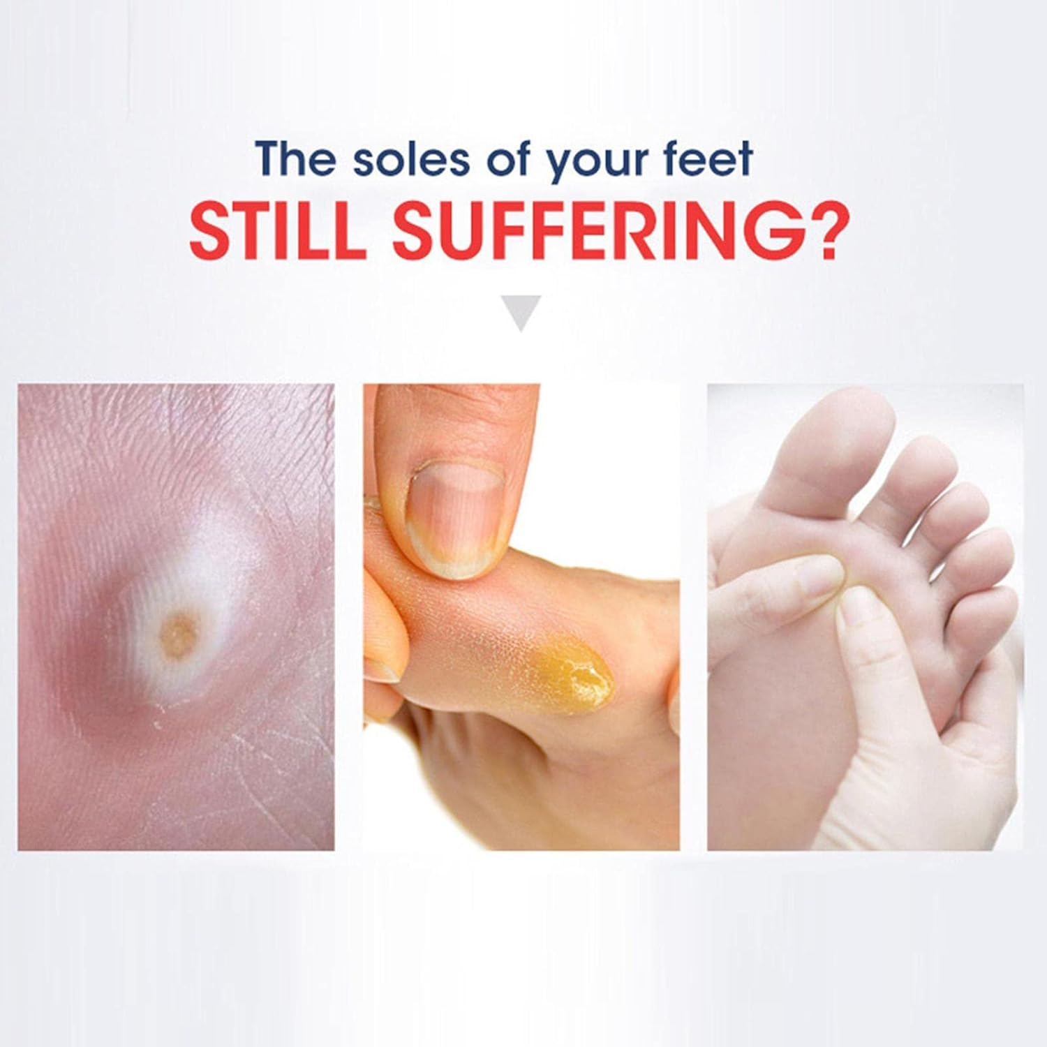 Callus Pads | Heel Callus Remover | Blister Removal Patches With, Foot Care Plaster for Corns, Callus, or Plantar image number 5