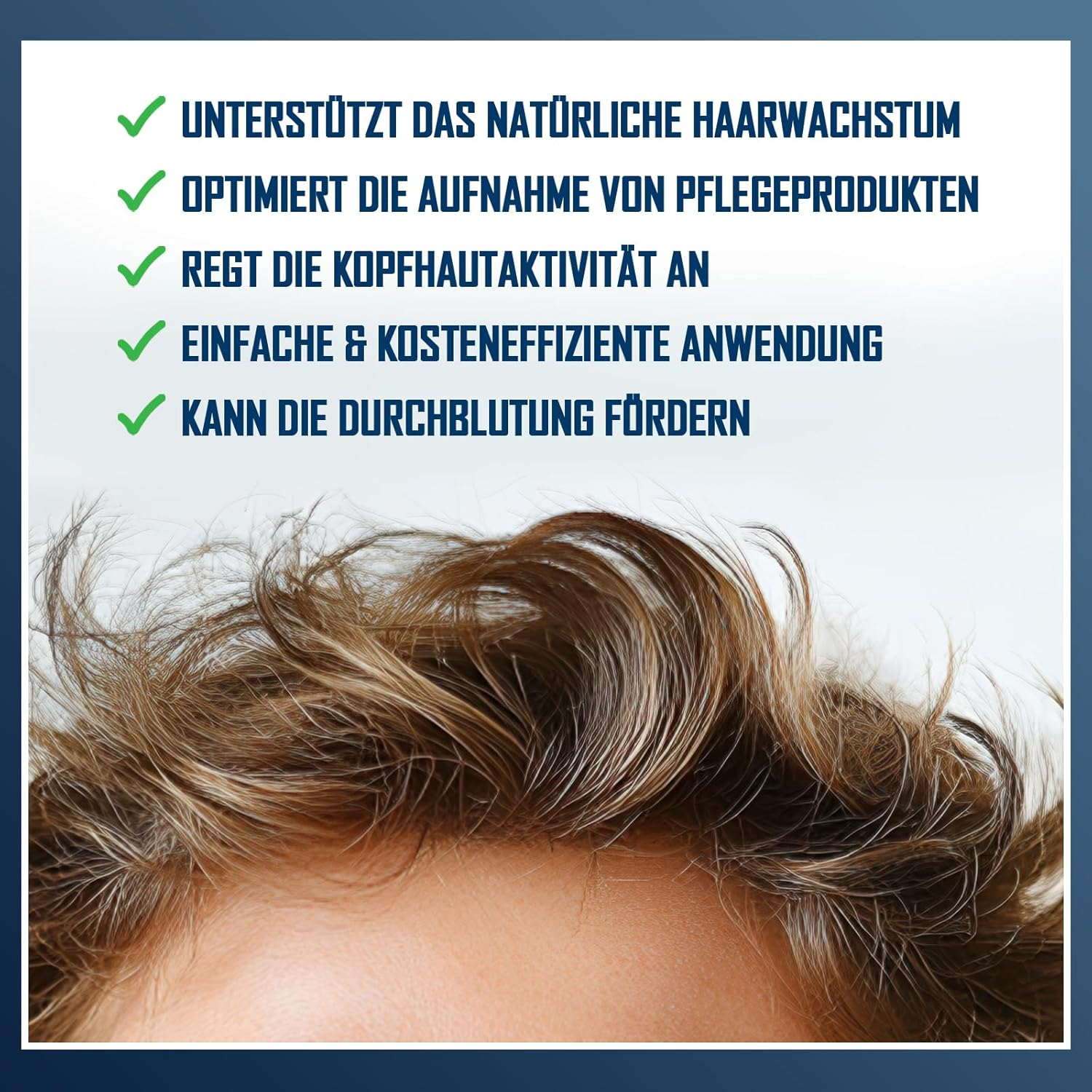 Efficient Microneedling Derma Roller Men - 192 Real Stainless Steel Needles against Hair Loss | Hair Roller & Beard Roller for Hair Growth | Minoxidil Compatible | Beard Care Tool - Skinfuture&reg; image number 1