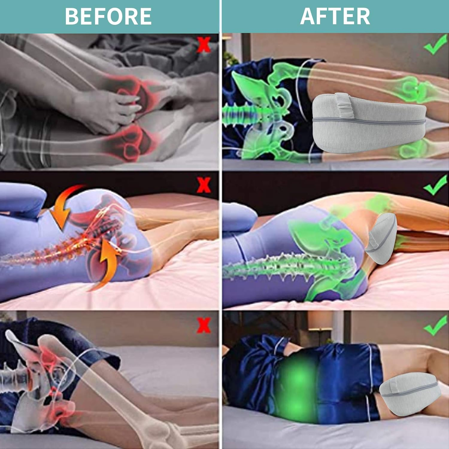 CREATESTAR Leg Pillow Knee Pillow Ergonomic Side Sleeper Pillow with Optimal Memory Foam Pillow for Side Sleepers Positioning Pillow with Removable and Washable Cover image number 4