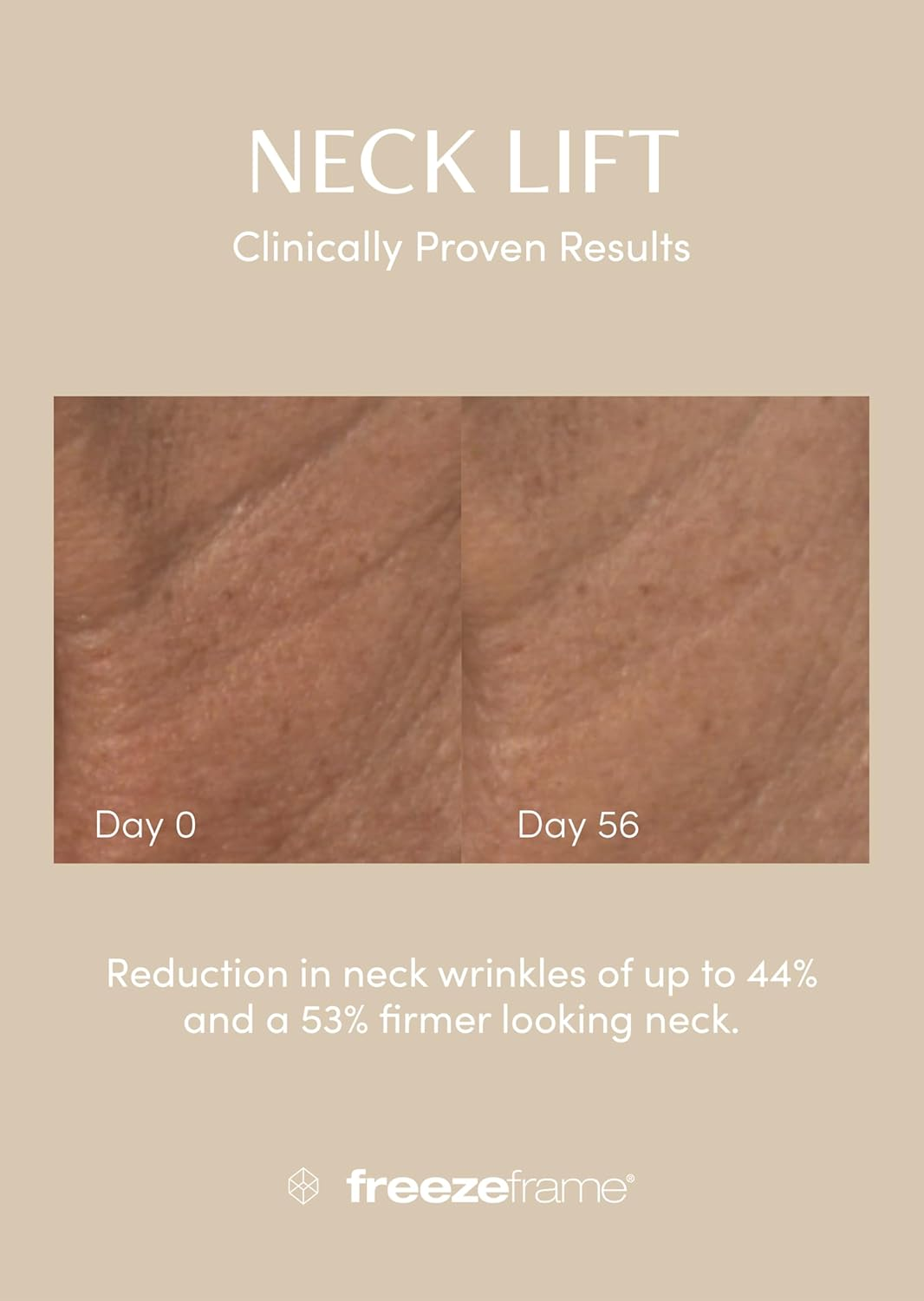 Freezeframe NECK LIFT image number 5