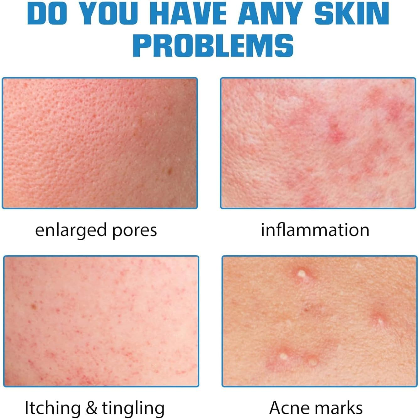 Micro Infusion System for Face,Micro Infusion System for Lips,Facial System with Serum,For All Skin Types image number 4