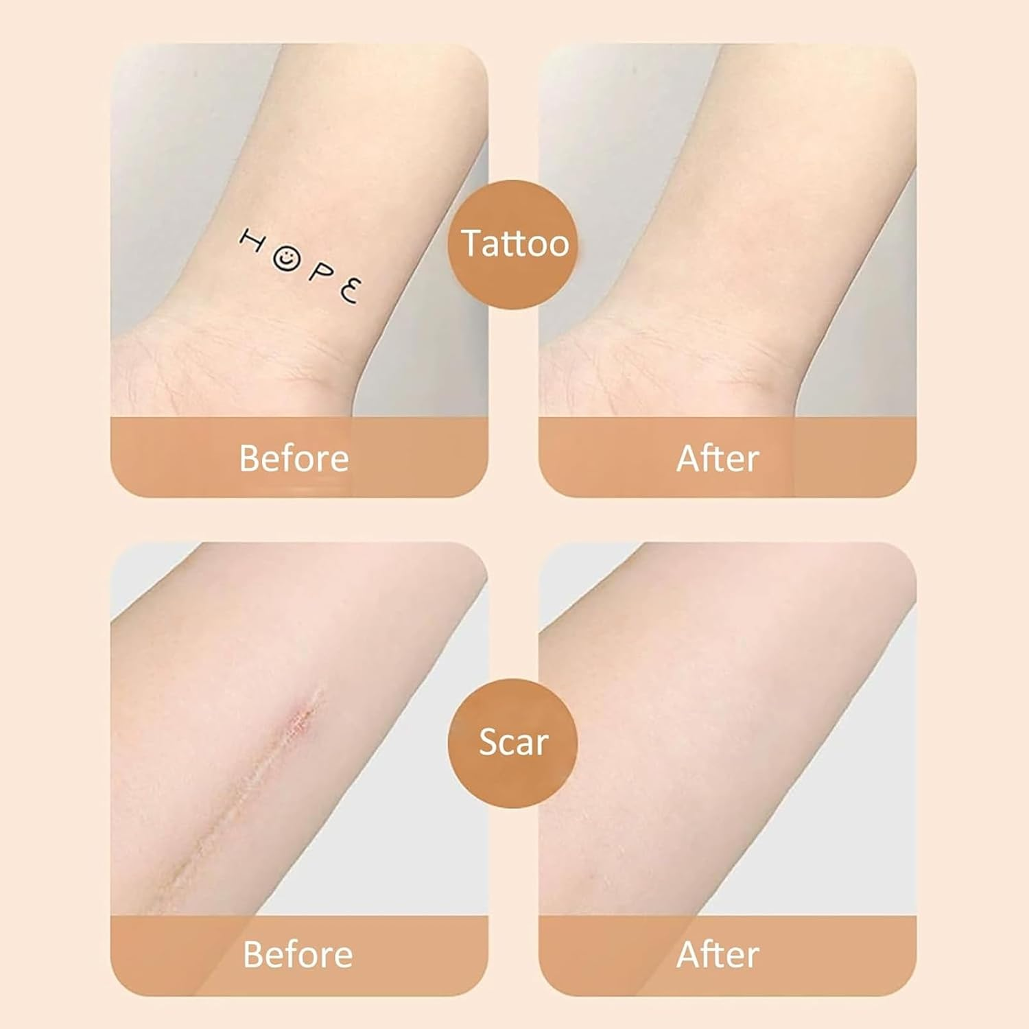 Muhomuho 10Pcs Tattoo Cover up Patch, Scar Tape, Second Skin for Tattoo, Invisible Waterproof Body Concealer Makeup Sticker, Natural Looking Cover up for Tattoos & Scars (Light)