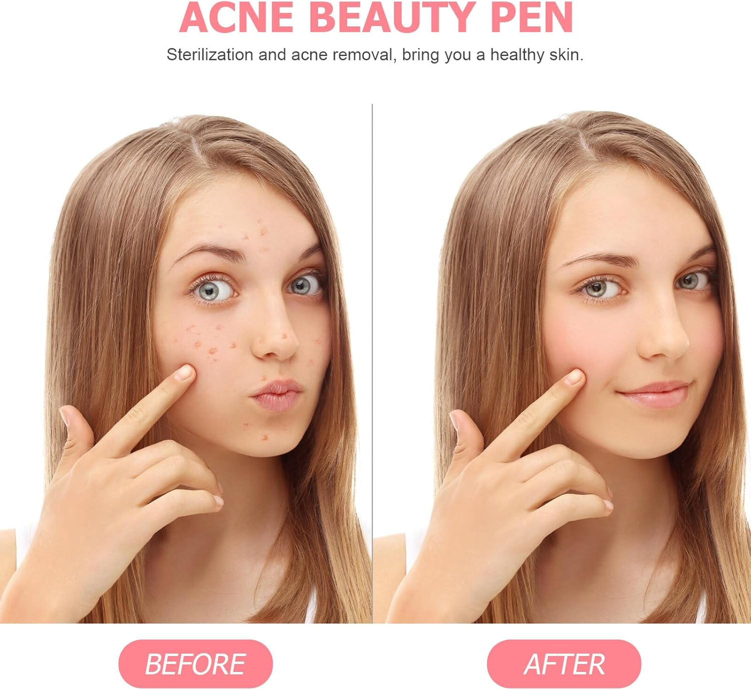 TOPPERFUN Red Blue Light Remover Pen Facial Scar Treatment Device Safe Skin Care Massager for Oily and Sensitive Face and Neck image number 1