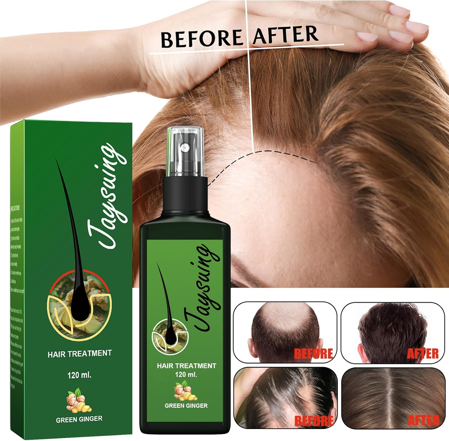 Green Ginger Hair Treatment Spray, 120Ml image number 5