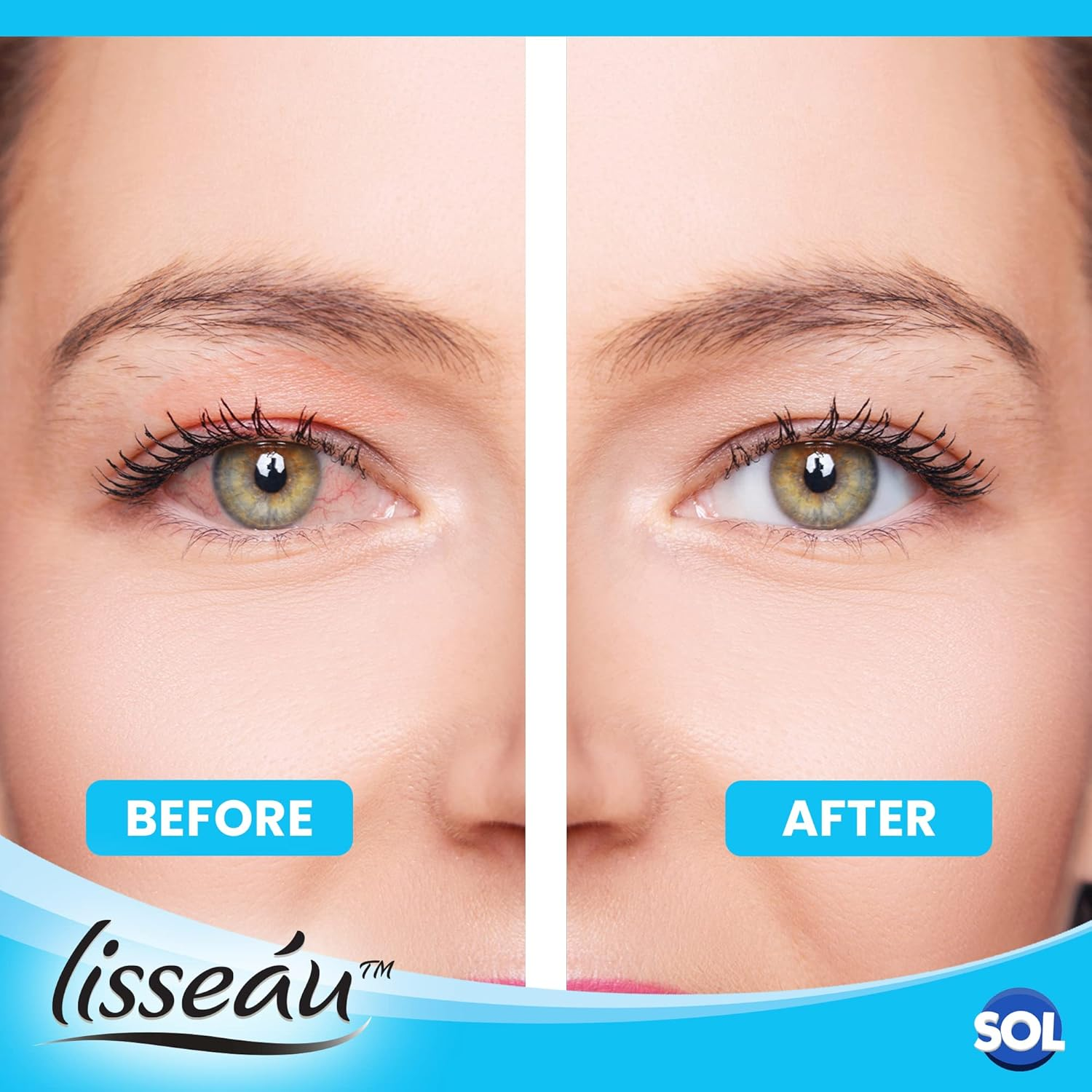 SOL 6Pk Eye Spray | Dry Eye Spray | Dry Eyes Treatment | Eye Spray for Tired and Dry Eyes | Eye Mist | Eye Spray for Itchy Eyes | Eye Mist Spray for Dry Eyes | Itchy Eye Spray image number 4