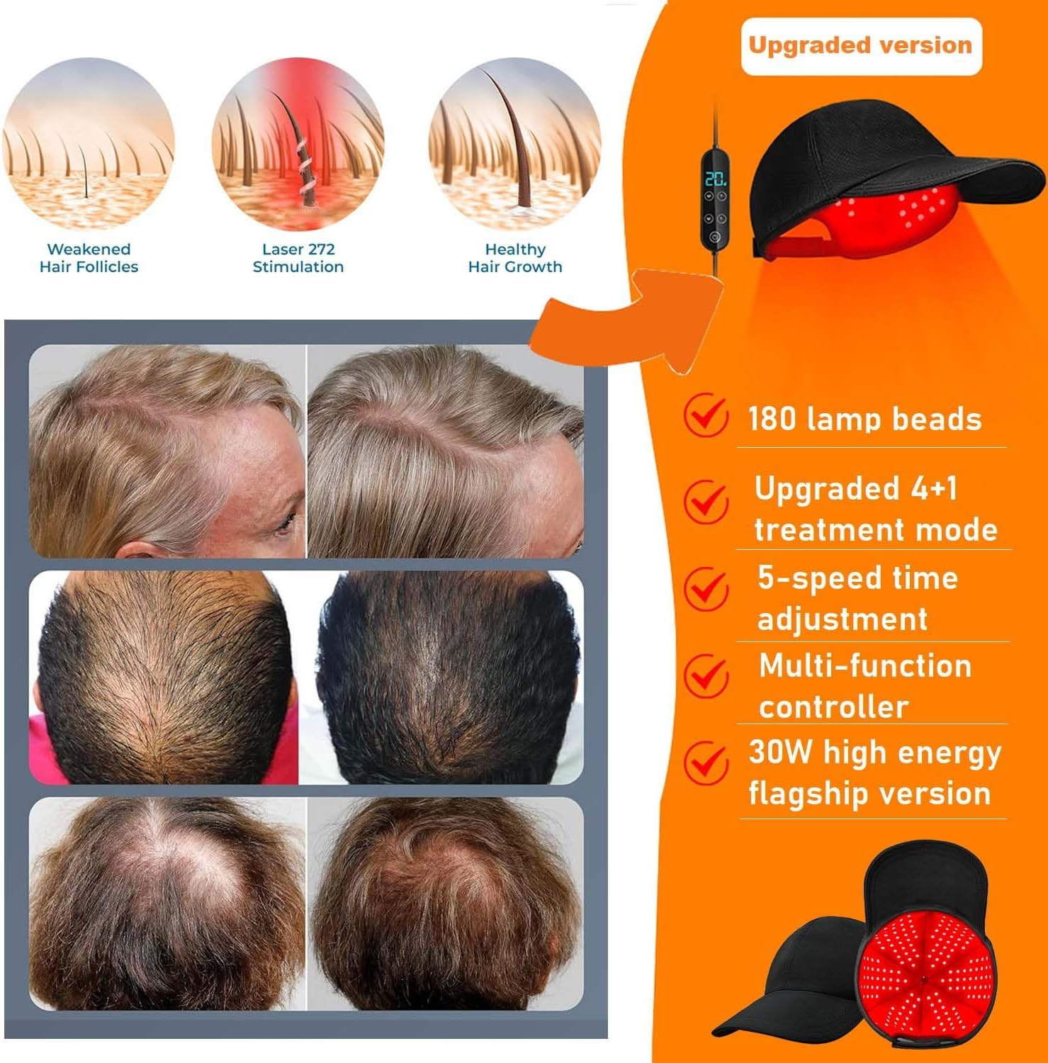 Therapy for Hair Growth|Red Light Hair Growth System|Hair Loss in Men & Women|Advanced Hair Regrowth System|Red Light Therapy Cap image number 2