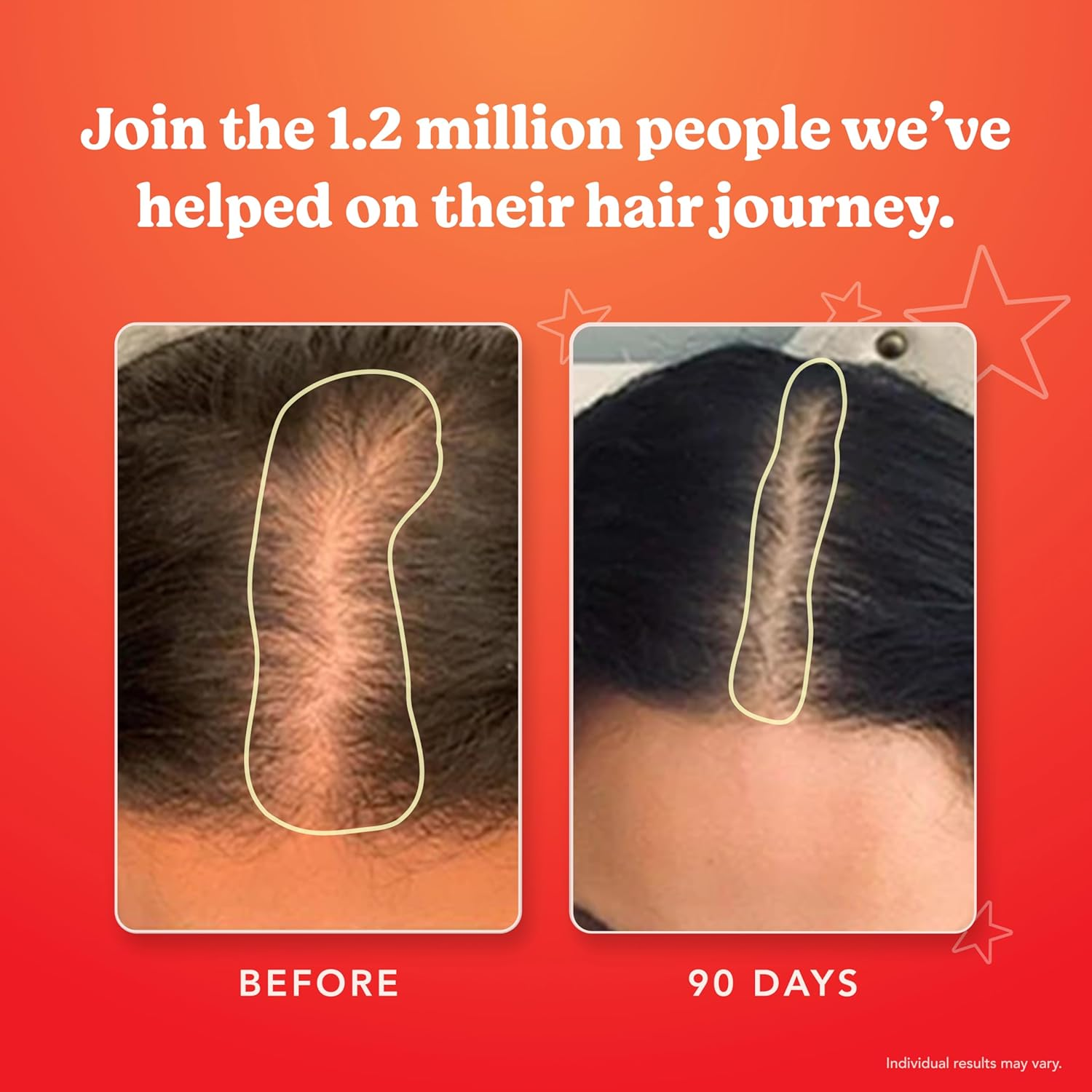 Hairtamin Star Gummy Hair Vitamins - Made in USA - Biotin Gummies Hair Vitamins for Faster Hair Growth for Women & Men - Gluten-Free, Low Carb, Vegan Hair Supplement Multivitamin for Hair Skin Nails image number 2