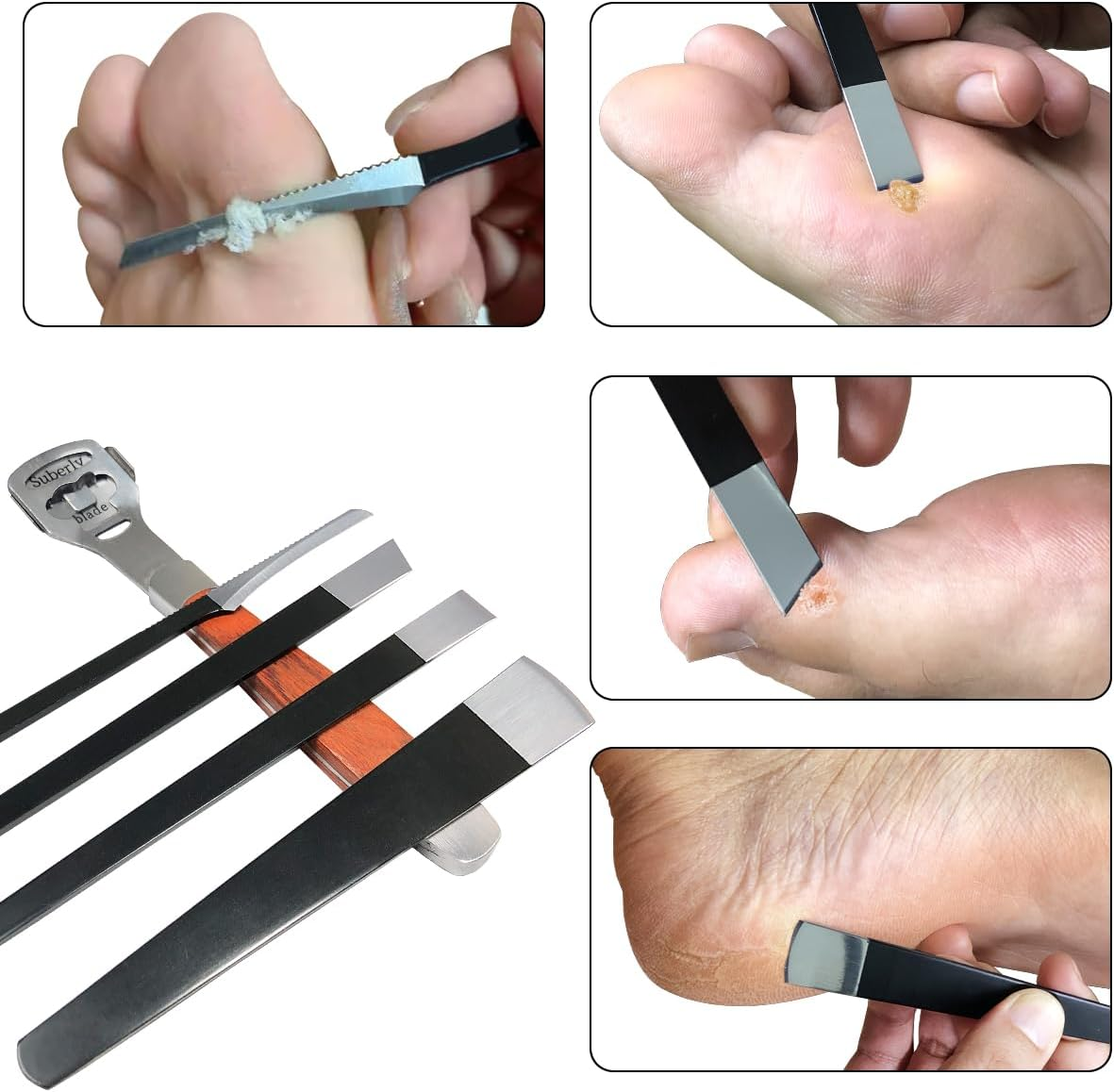 36 Pcs Callus Shaver for Feet Set, (1Stainless Foot File &1 Foot File Heads & 4 Pedicure Knife & 30 Replacement Slices Blades), Professional Callus Remover for Feet Tools for Wet and Dry Feet image number 5