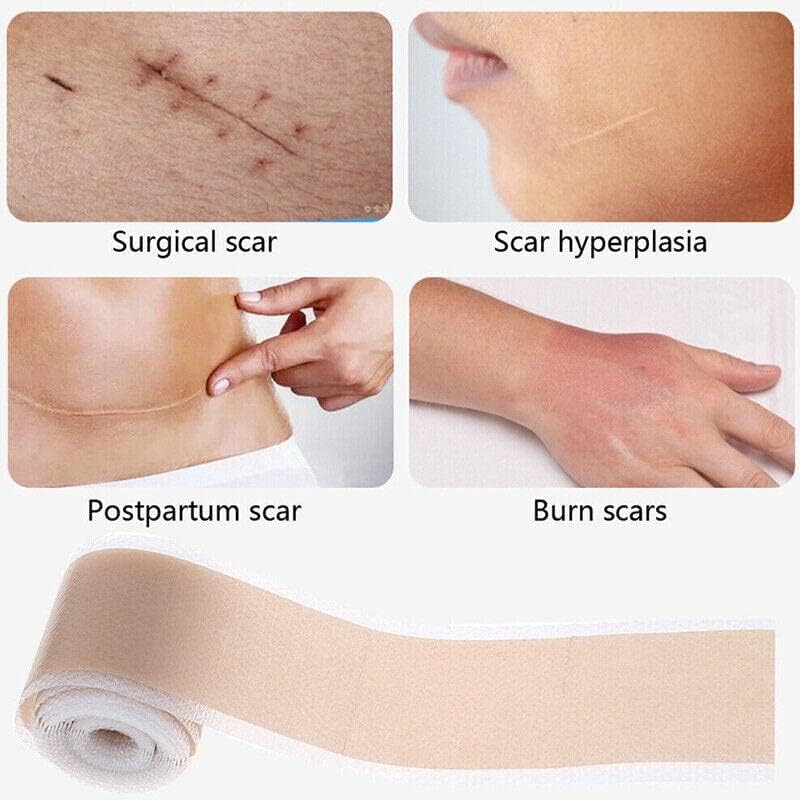 Silicone Gel Tape Scar Removal Self-Adhesive Efficient Scar Removal Patch Tapes