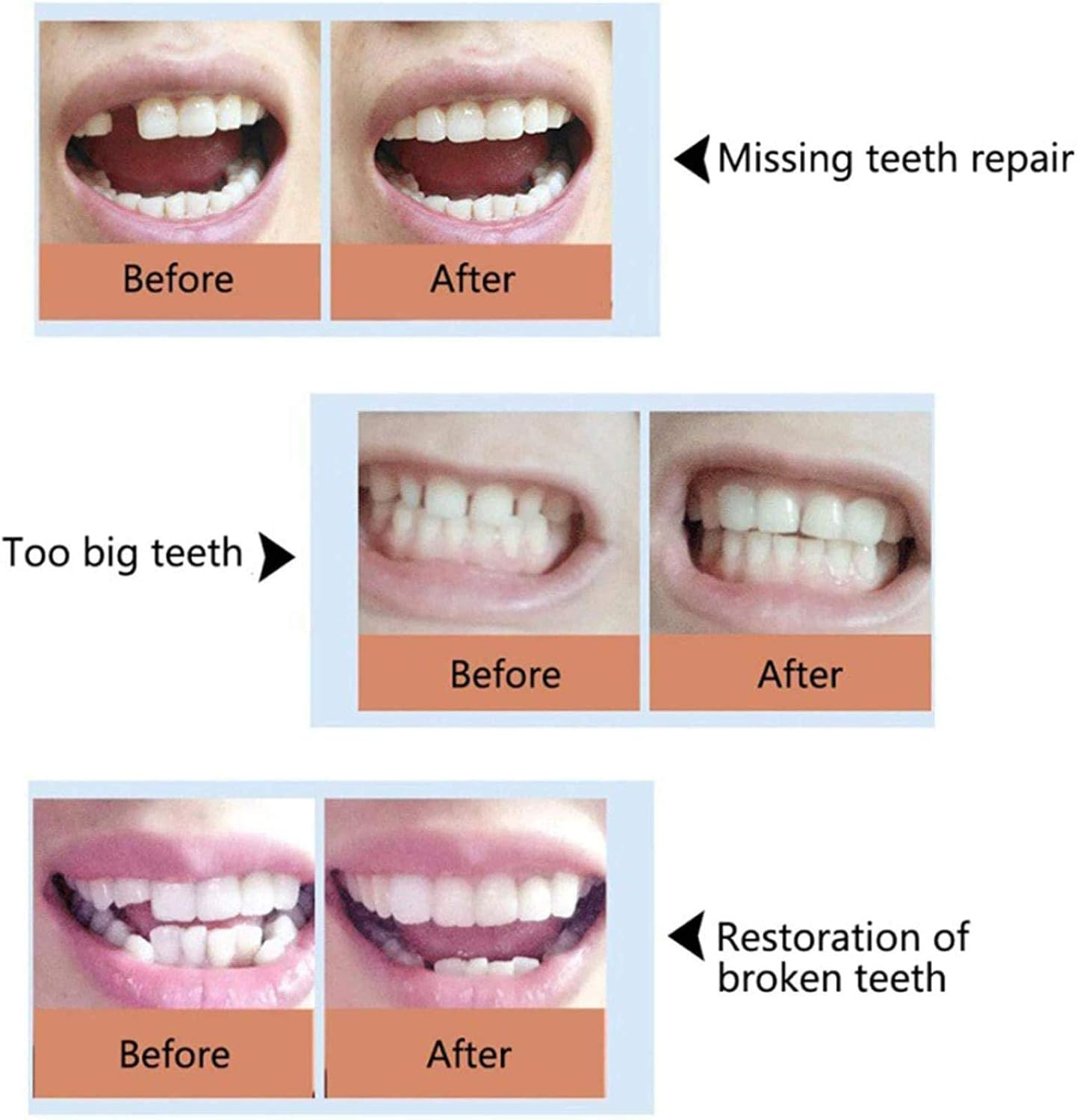 Wiruswin 153-02-02 Elegant MAXAM (SG17J) 153-02-02 Tandem Bar 1.5 in (38 Mm) image number 3
