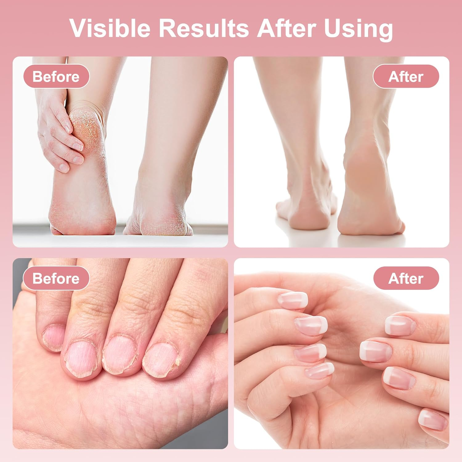 Electric Foot Callus Remover, 2 in 1 Rechargeable Foot File for Feet & Nails, 9 Speed Controller Callus Remover with Replaceable Sandpaper, Cordless Pedicure Tools for Dead Skin and Calluses (Pink) image number 2