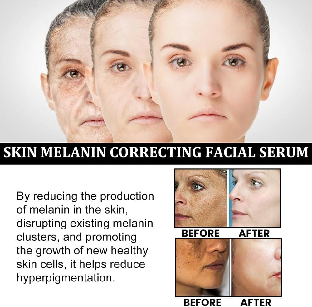 2024 Melanin Correcting Facial Serum, Dark Spot Correcting Radiance Serum,Moisturizing Repairing Serum for Glowing Skin - 3Pcs image number 2