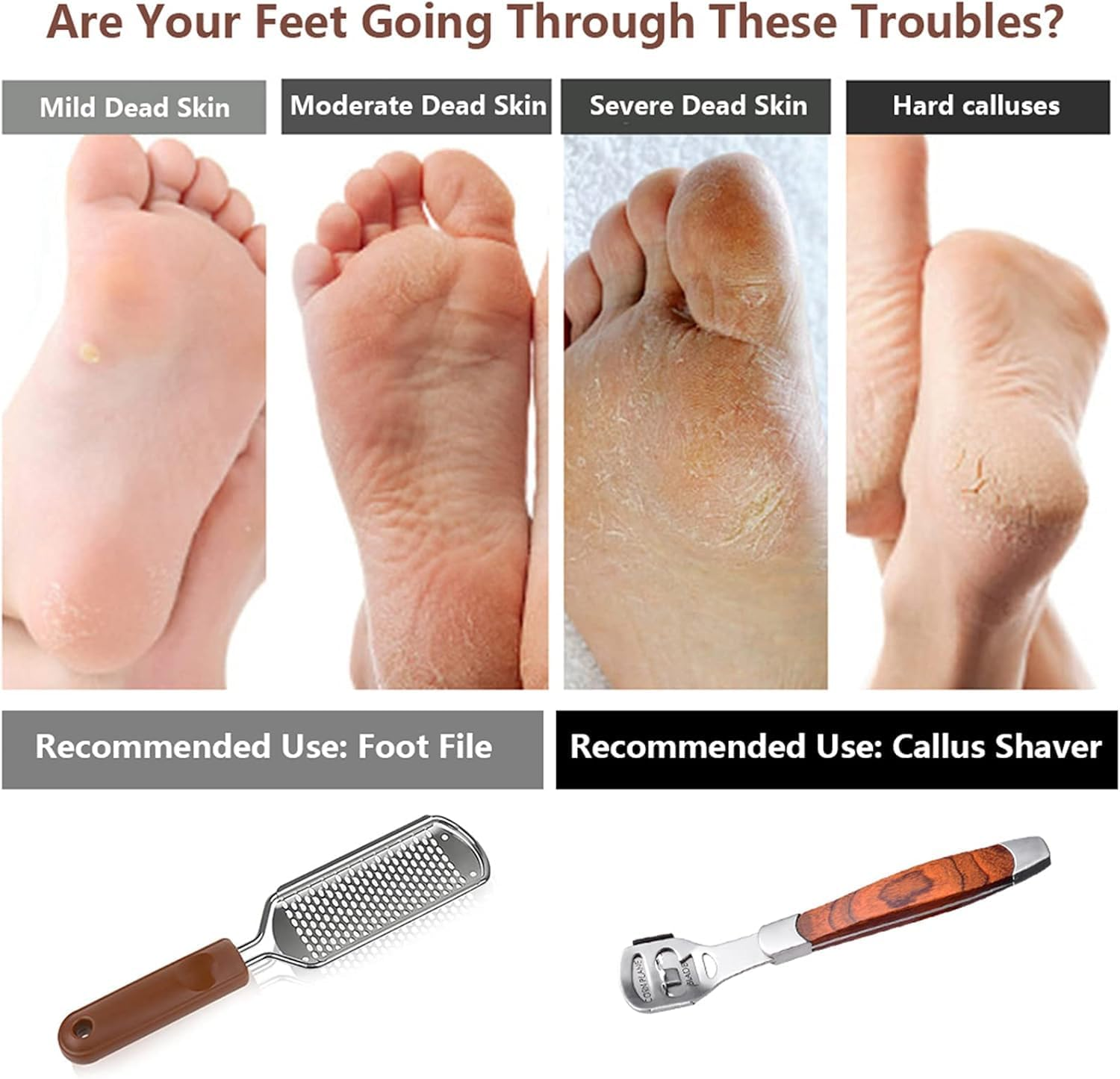 2Pcs Foot File and Callus Remover Tool with 20 Blades,Ergonomic Handle, Pedicure Foot File Kit for Wet/Dry Use on Cracked Heels, Dead Skin and Corns image number 1