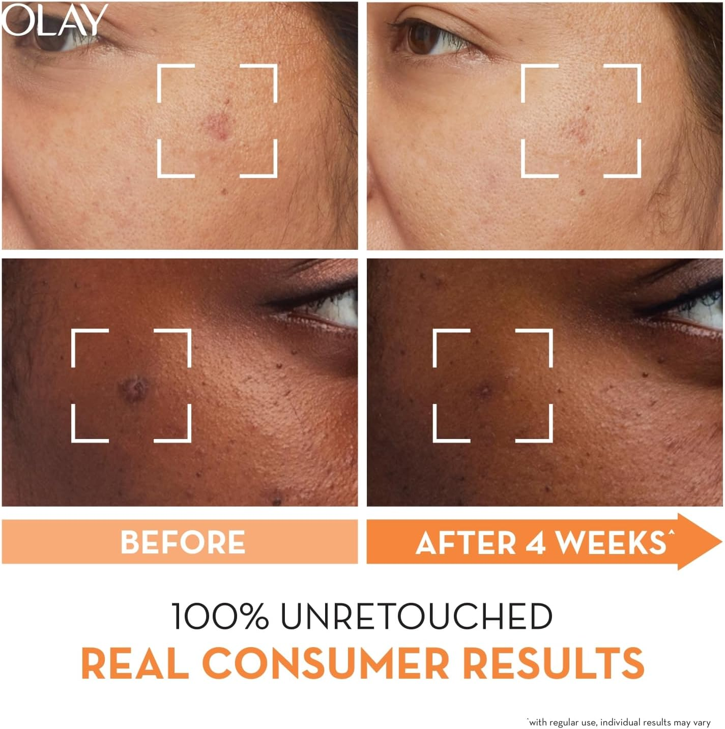 Olay Luminous Niacinamide + Vitamin C Face Cream Moisturiser 50G image number 6