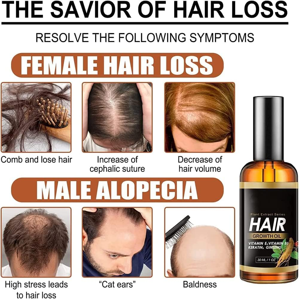 2Pcs Suna Plant Extract Hair Growth Oil,Ginger Germinal Essential Oil Hair Growth Hair Loss Treatment Hair Care Hair Growth Serum for Men & Women image number 5