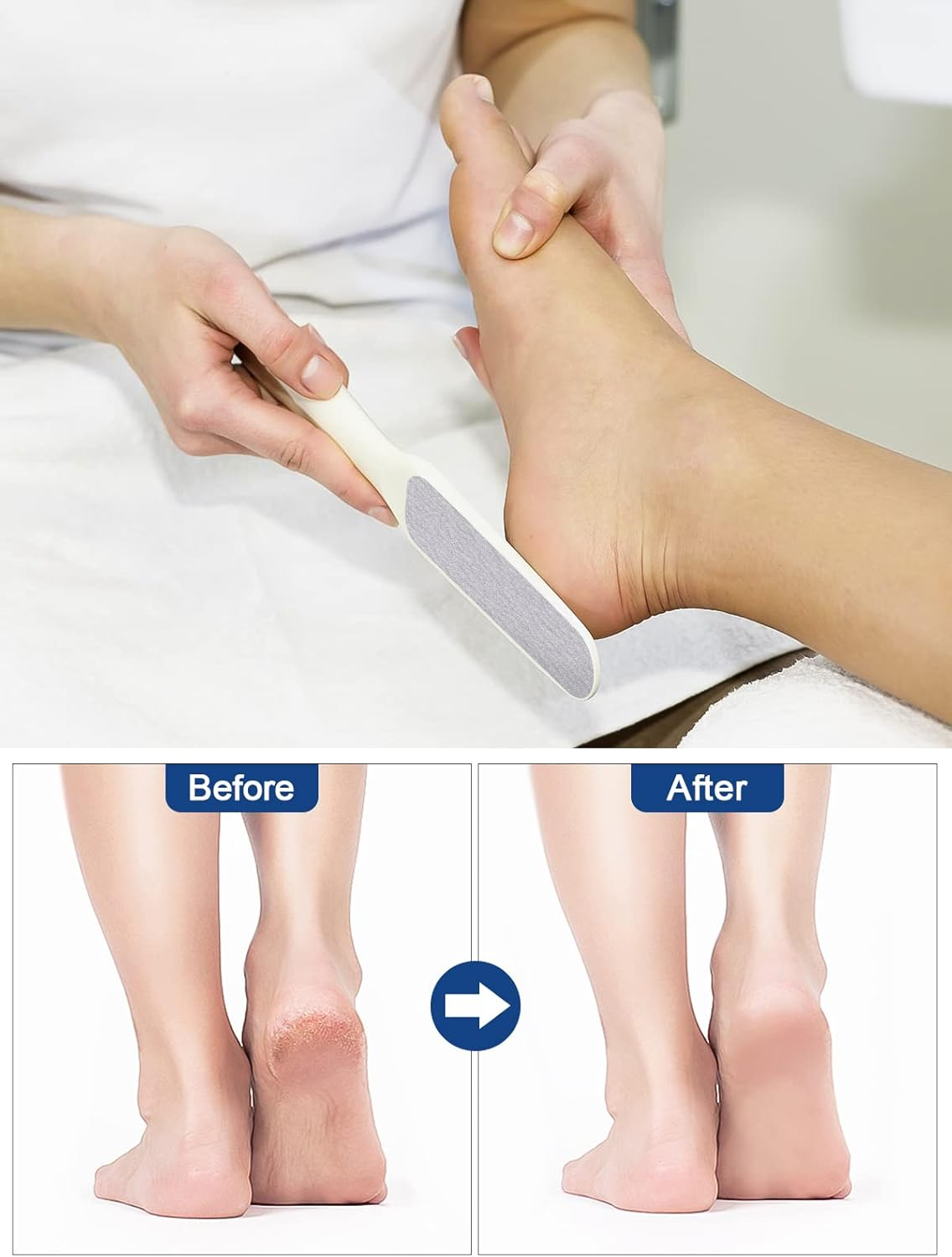 EBANKU 50 PCS Foot Files Reusable Stainless Steel Foot File Callus Remover Professional Abrasive Feet Rasp Foot Refill Pads Pedicure Sandpapers Replacement (Gray)