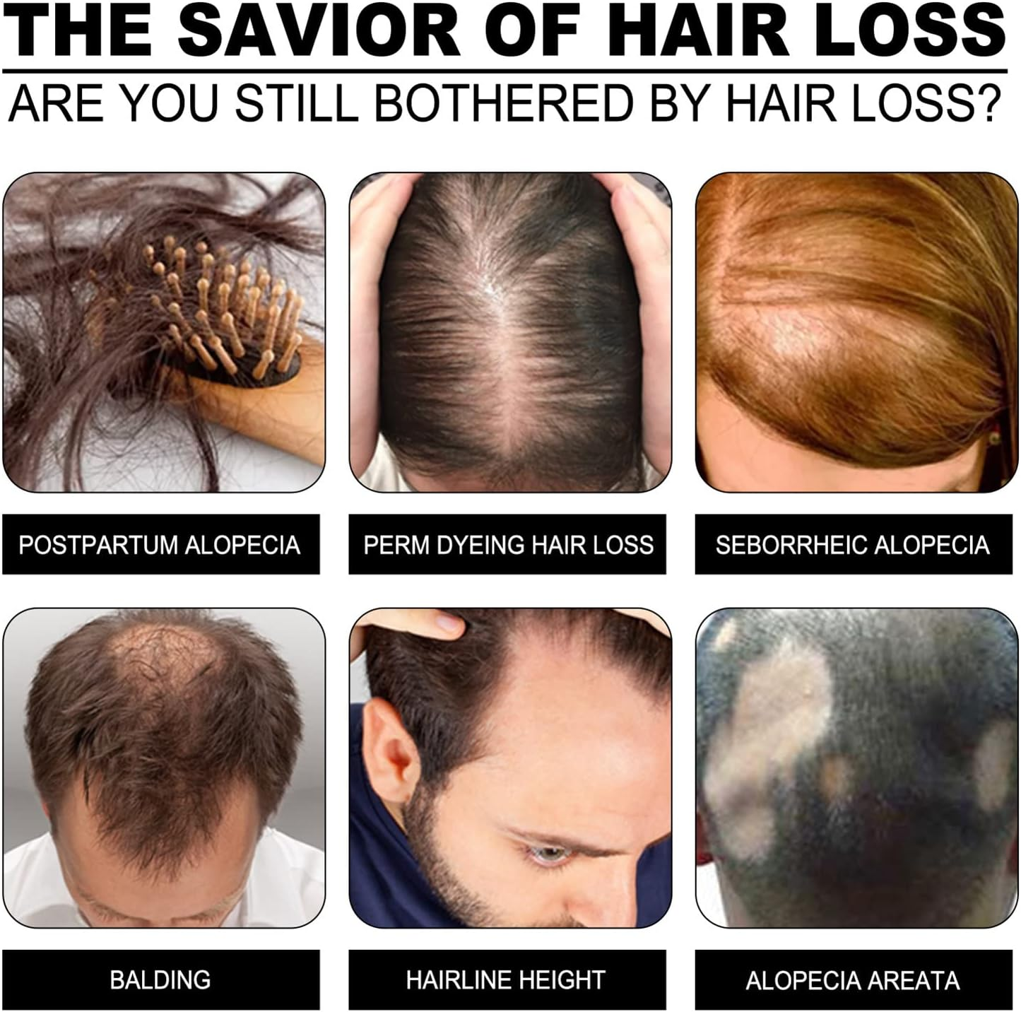 Daseey 1Pc Hair Growth Rice Soap Shampoo Bar Nourish Hair Root Balance Oily Scalp Increase Hair Volume image number 1