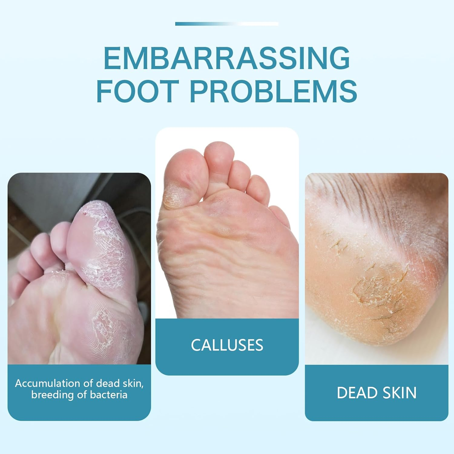 C12Rtive Pedicure Drill Bit, Diamond Carbide Foot Nail Drill Bit,Stainless Steel Professional Pedicure Foot Calluses Sanding Polishing Bits for Cracked Skin Callus Removal for Home Salon & Diy(Coarse) - Coarse image number 5