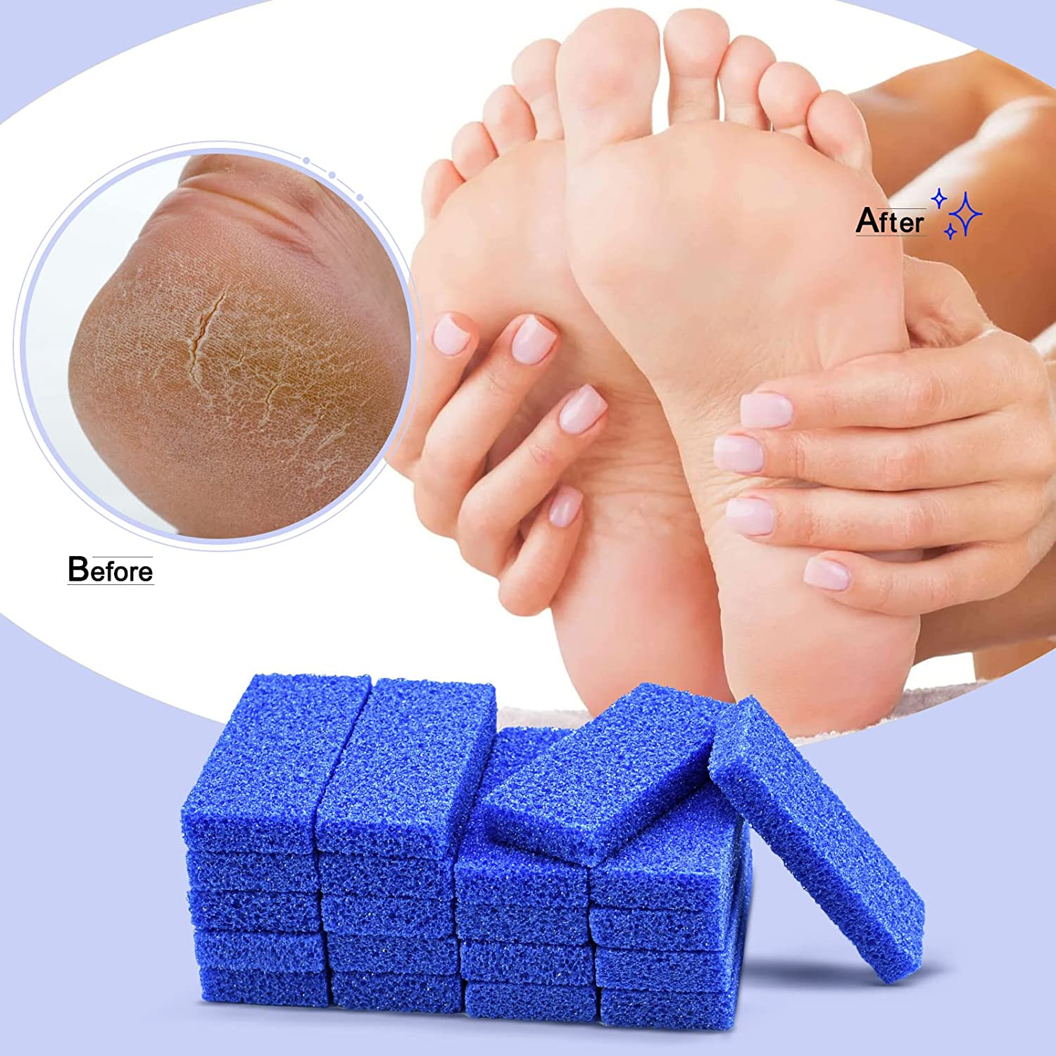Disposable Foot Scrubber Sponge Pads Pedicure Pumice Stone for Feet Callus Remover Coarse Blue 40Pcs image number 3