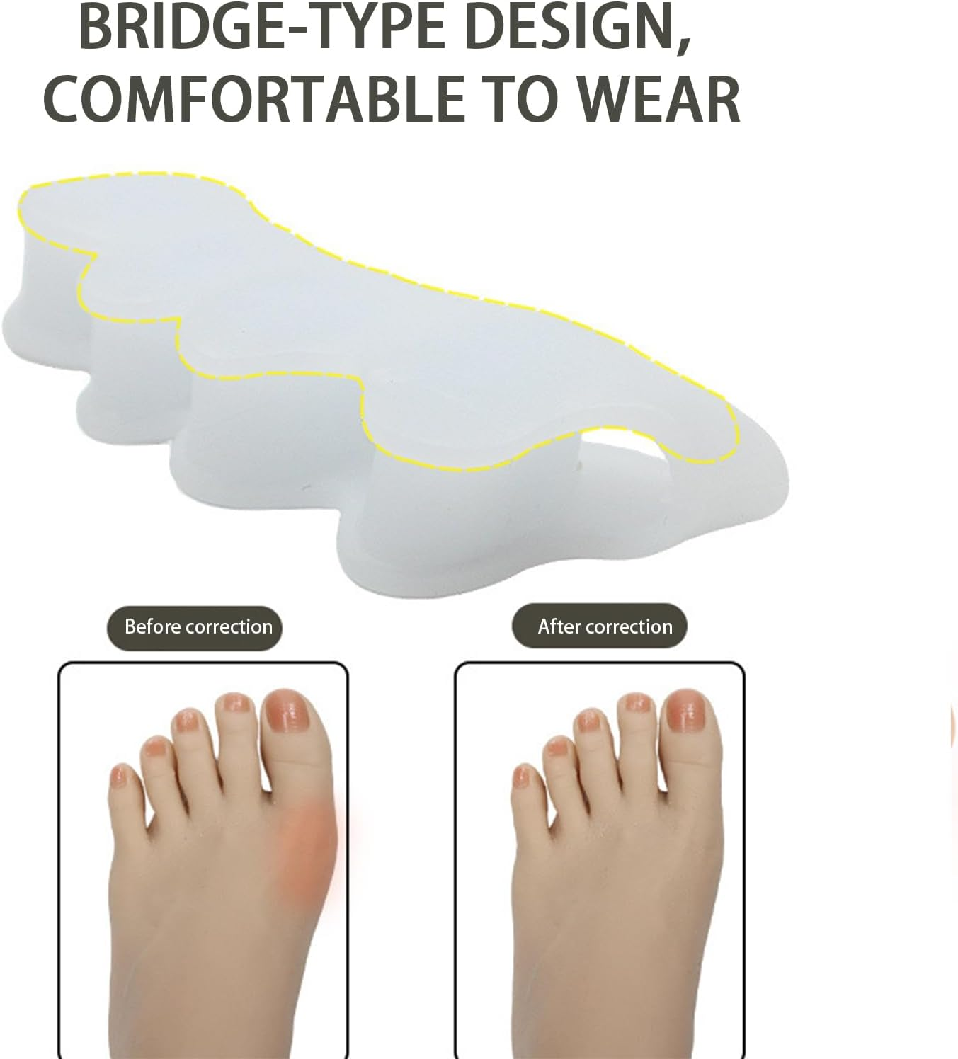 4 Pairs Soft Gel Toe Spacers for Bunion Correction Toe Separators Therapeutic Relief for Plantar Fasciitis Hammer Toes Claw Toes Foot Pain for Women Men Blue White image number 1