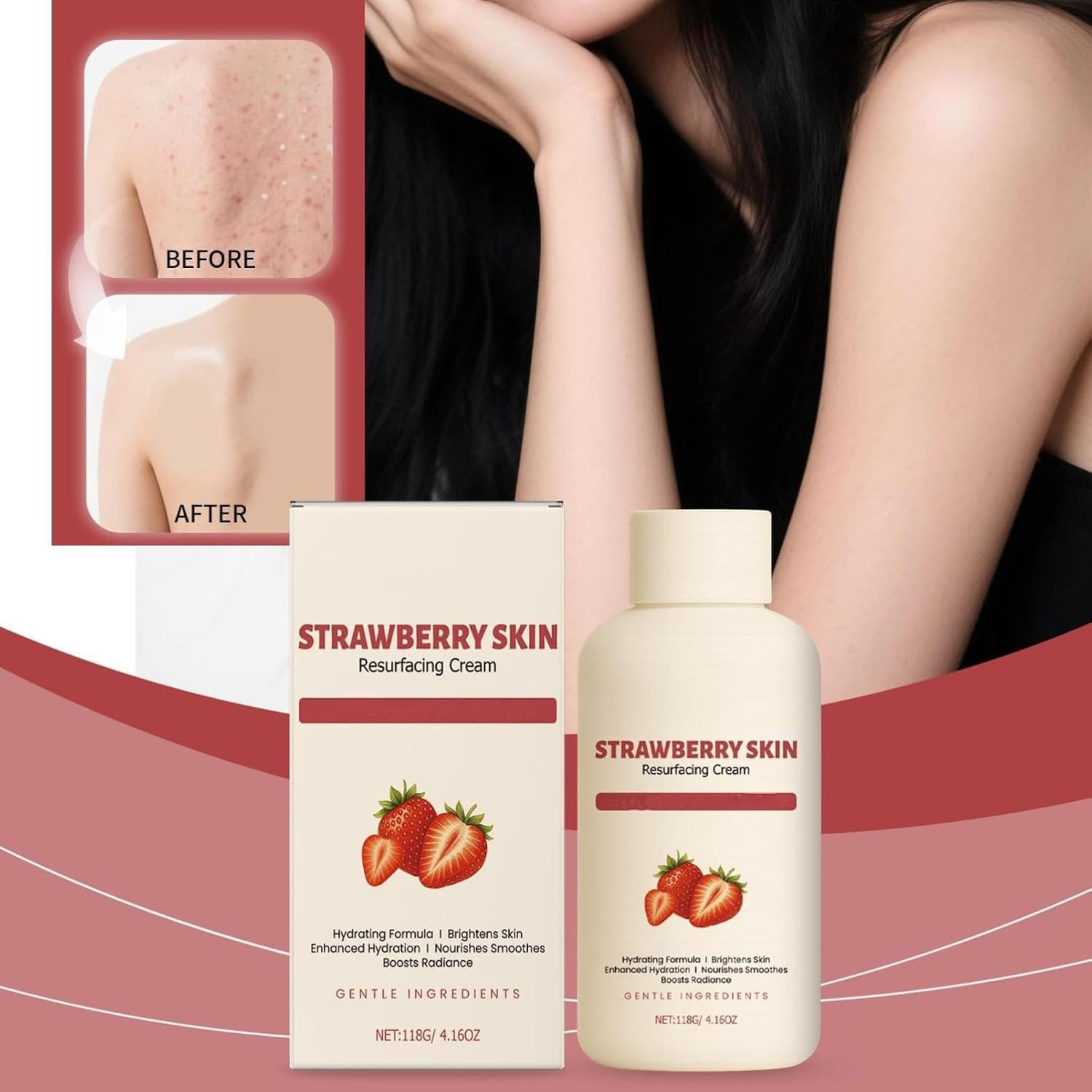 Strawberry Skin Resurfacing Cream, Strawberry S/Kin Treatment, Legs Treatment Body Cream, Anti-Wrinkle Moisturizing Lotion,Smooth Arm and Leg, Reduce Chicken Skin Bumps and Uneven Textures (2PCS) image number 1