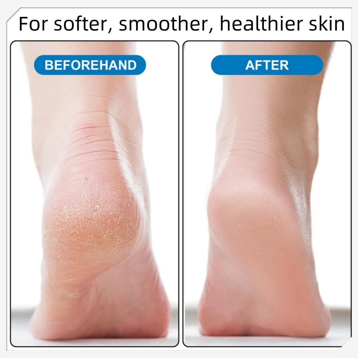 Ljxyloog 2Pcs Foot Care Exfoliator Pedicure Tool Foot Pumice Stone Block Remover Scrubber Dead Hard Skin Remover Cleaner Remover for Feet(Purple) image number 6