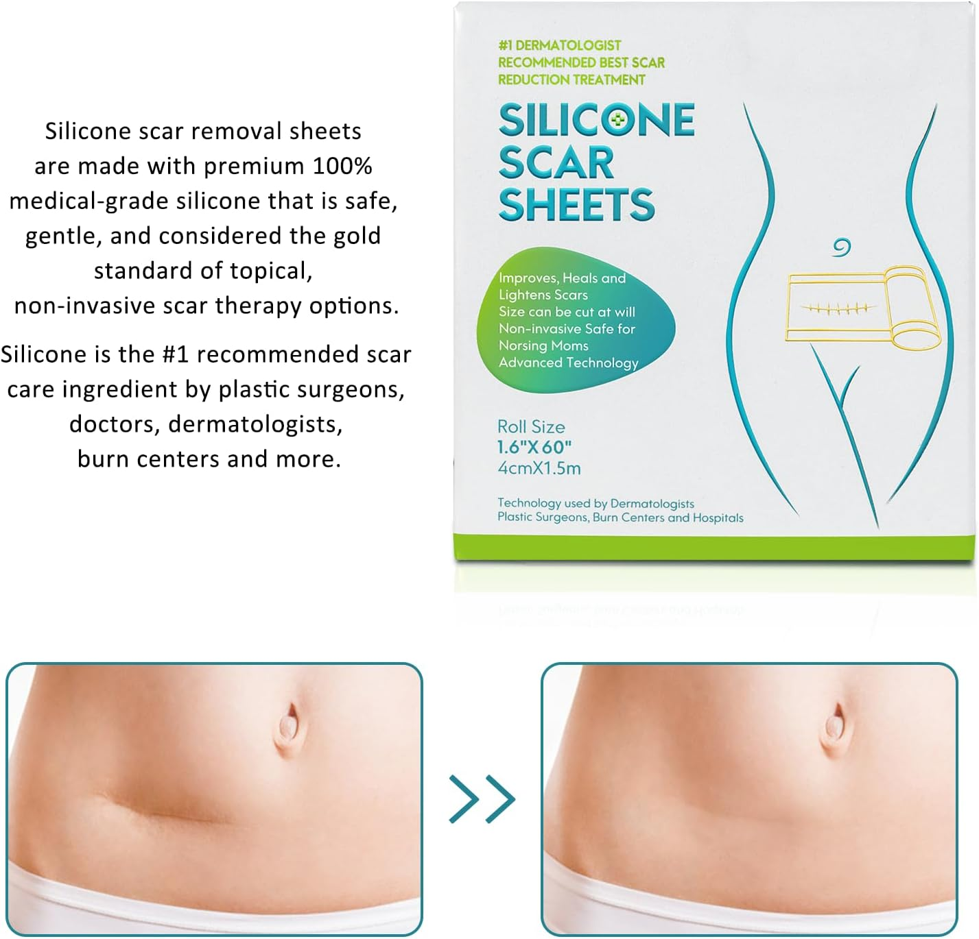 Silicone Scar Sheets(1.6&rdquo; X 60&rdquo;Roll-1.5M), Silicone Scar Tape Roll, Reusable Scar Silicone Strips, Professional Scar Removal Sheets for C-Section, Surgery, Burn, Keloid, Acne image number 3