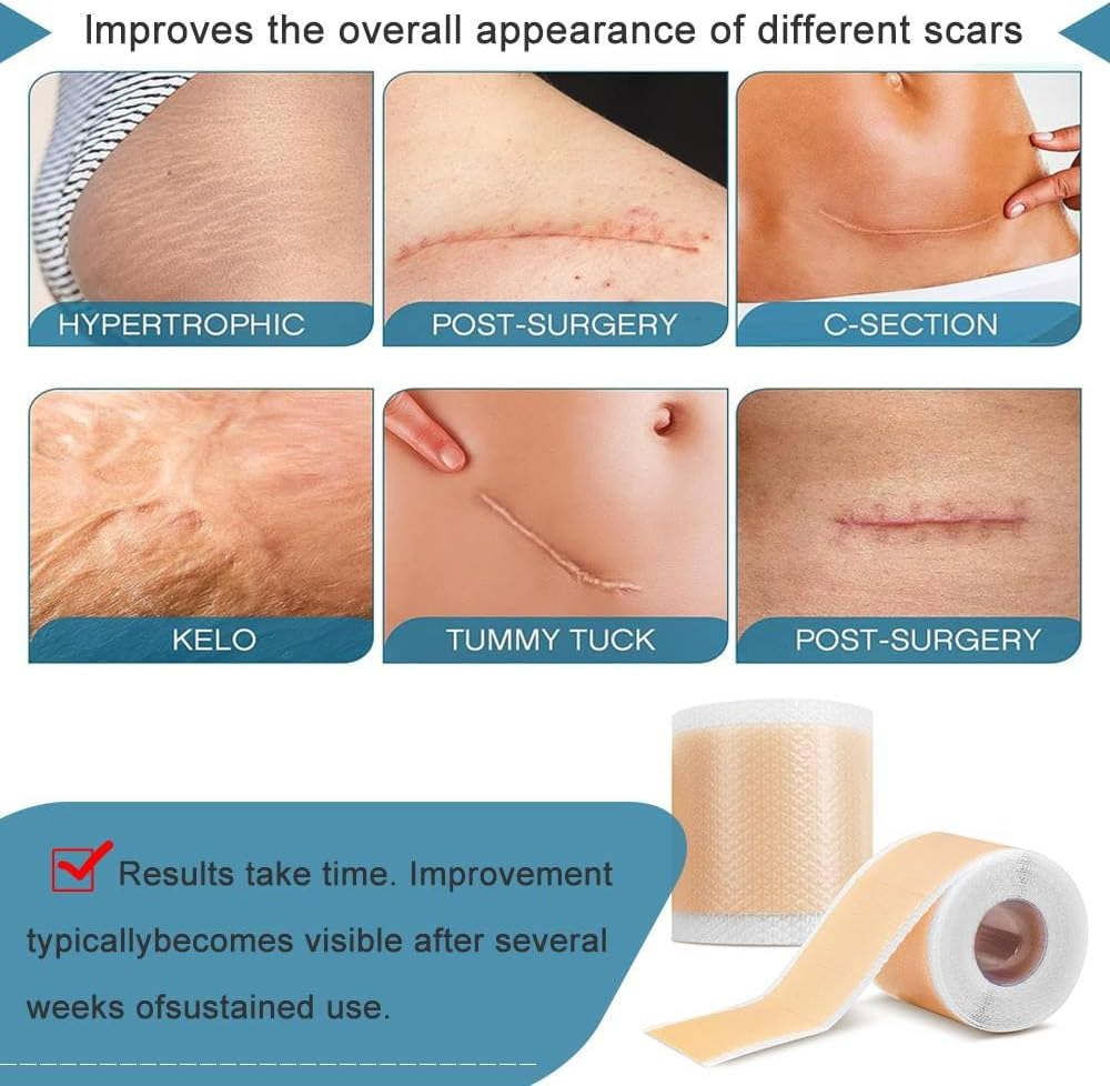 Silicone Scar Sheets, Soft Easy Tear Silicone Scar Tape (1.6"X 120" Roll-3M), Reusable Scar Removal Sheet, Scar Removal Away Strips for Surgical Scars, Keloid Scars, C-Section, Tummy Tuck, Acne Etc. image number 1