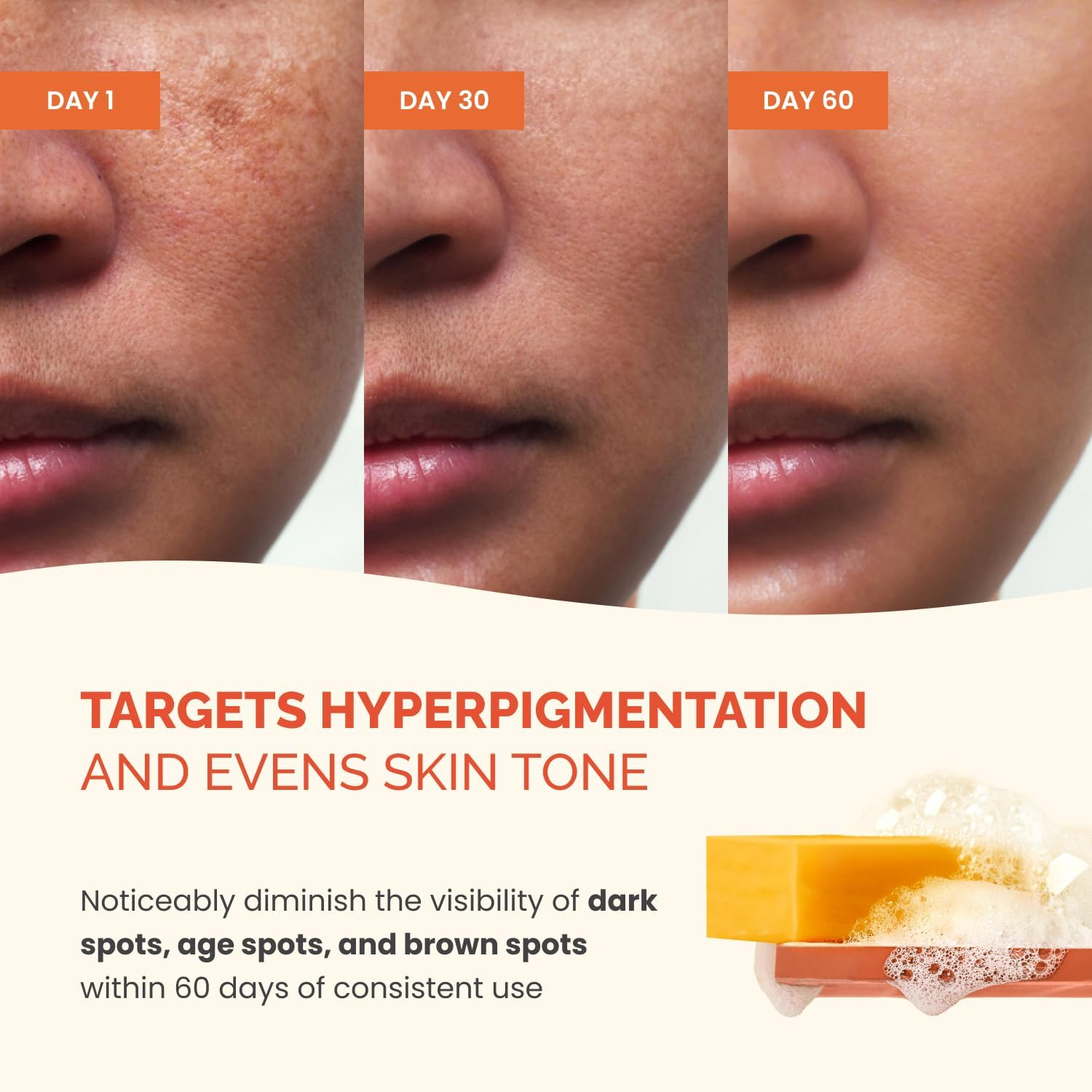 PLANTIFIQUE Kojic Acid Soap for Hyperpigmentation &ndash; Turmeric Soap Bars with Hyaluronic Acid, Collagen & Vitamin C for Dark Spots &ndash; Face & Body Wash for Women & Men, Vegan Skincare, 320G/11.28 Oz image number 3