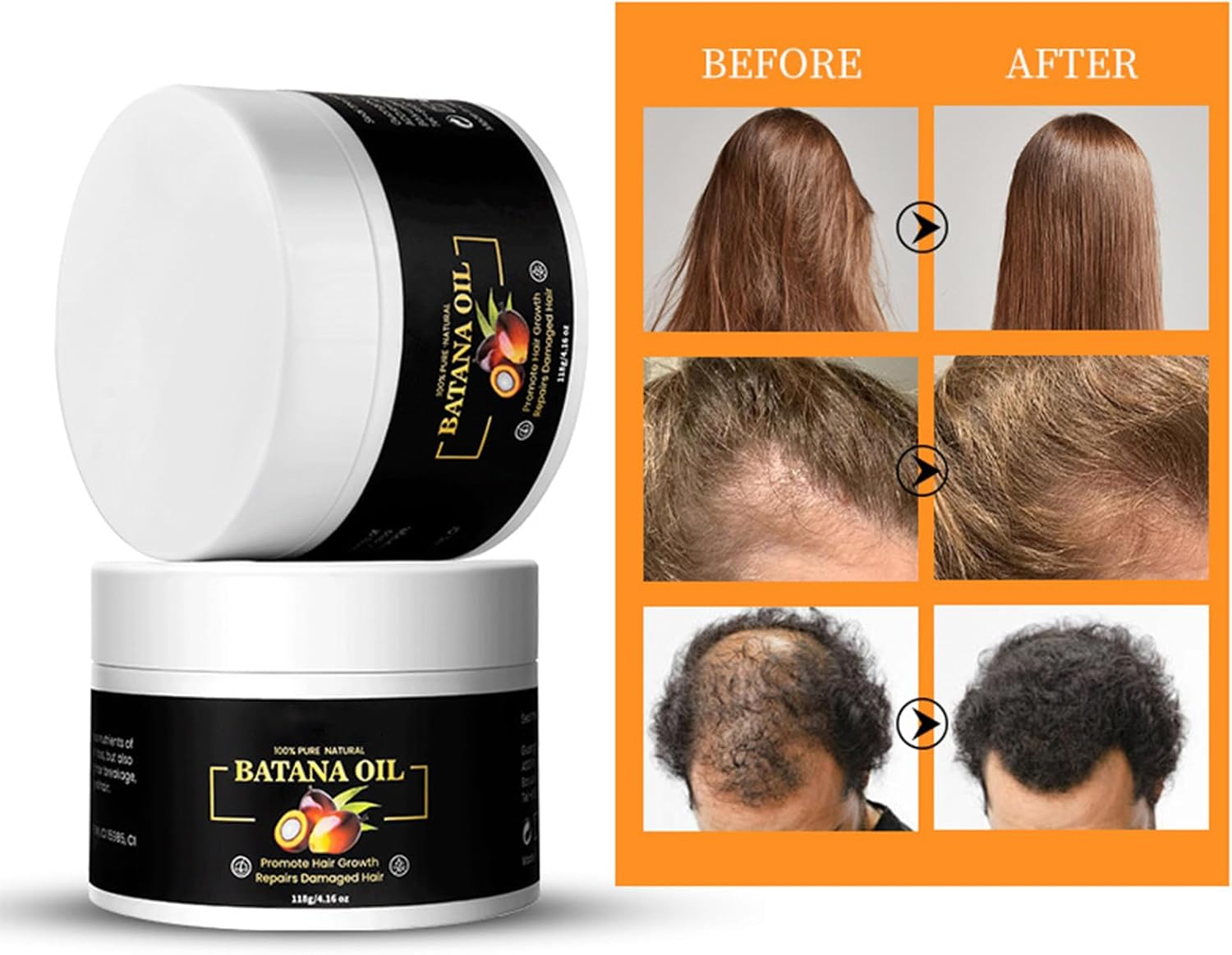 TTFP Batana Oil for Hair Growth - Organic Batana Oil Cream, Raw Batana Oil Hair Growth Treatment image number 5