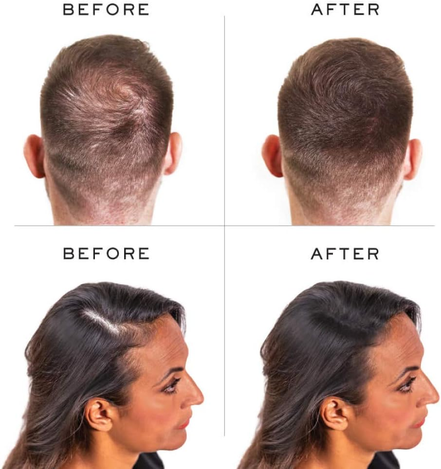 Nanogen Keratin Hair Fibers, 30-Grams, Light Brown image number 6