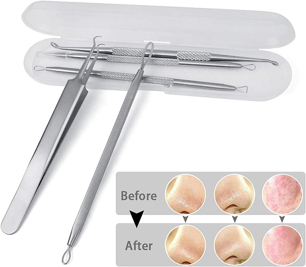 5PCS Blackhead Remover Tool Set Acne Extractor Comedone Pimples Spot and Zit Removal Tool with Case (Silver)