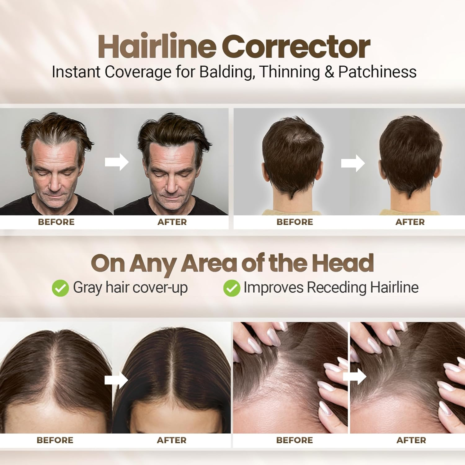 Koloret Root Touch up Powder&ndash; Medium Brown Powder for Women & Men, Instant Root Cover up for Gray Coverage, Hairline Concealer for Thinning Hair & Bald Spots, Water-Resistant & Smudge-Proof, 10G image number 5