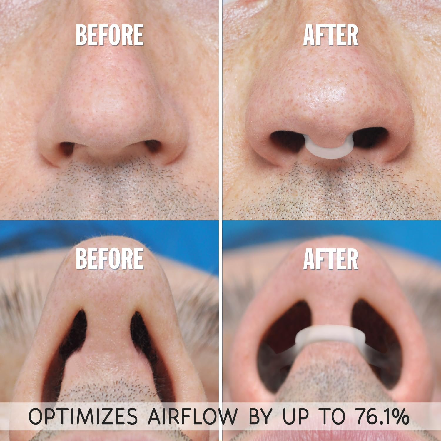 AIRMAX Nasal Dilator for Better Sleep - Natural, Comfortable, anti Snoring Device, Snoring Solution for Maximum Airflow & Easier Breathing (Medium - Clear) image number 5