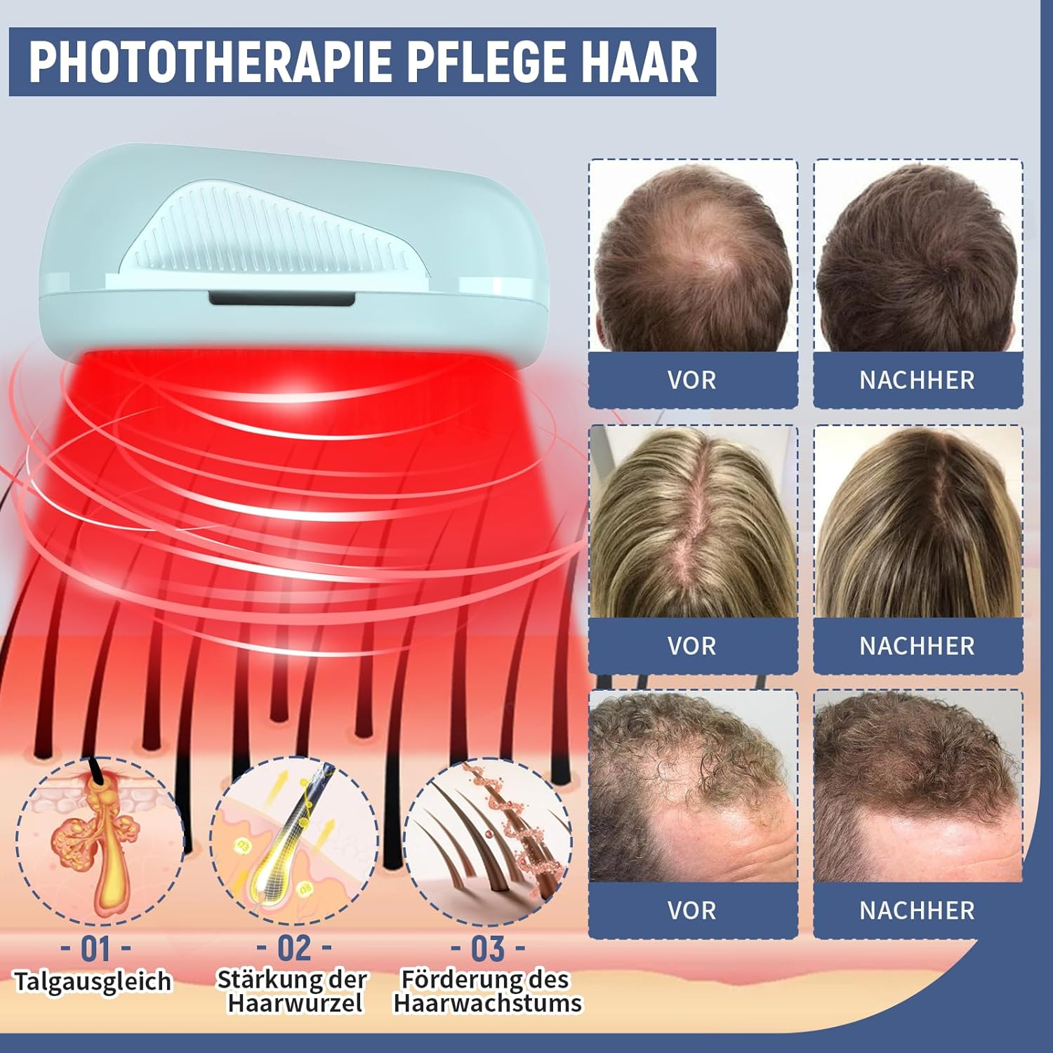 Hair Growth Laser Comb, Medical Grade Laser, FDA Approved Hair Loss Treatment for Men and Women with Thinning Hair, Rechargeable Hair Growth Product (Blue)