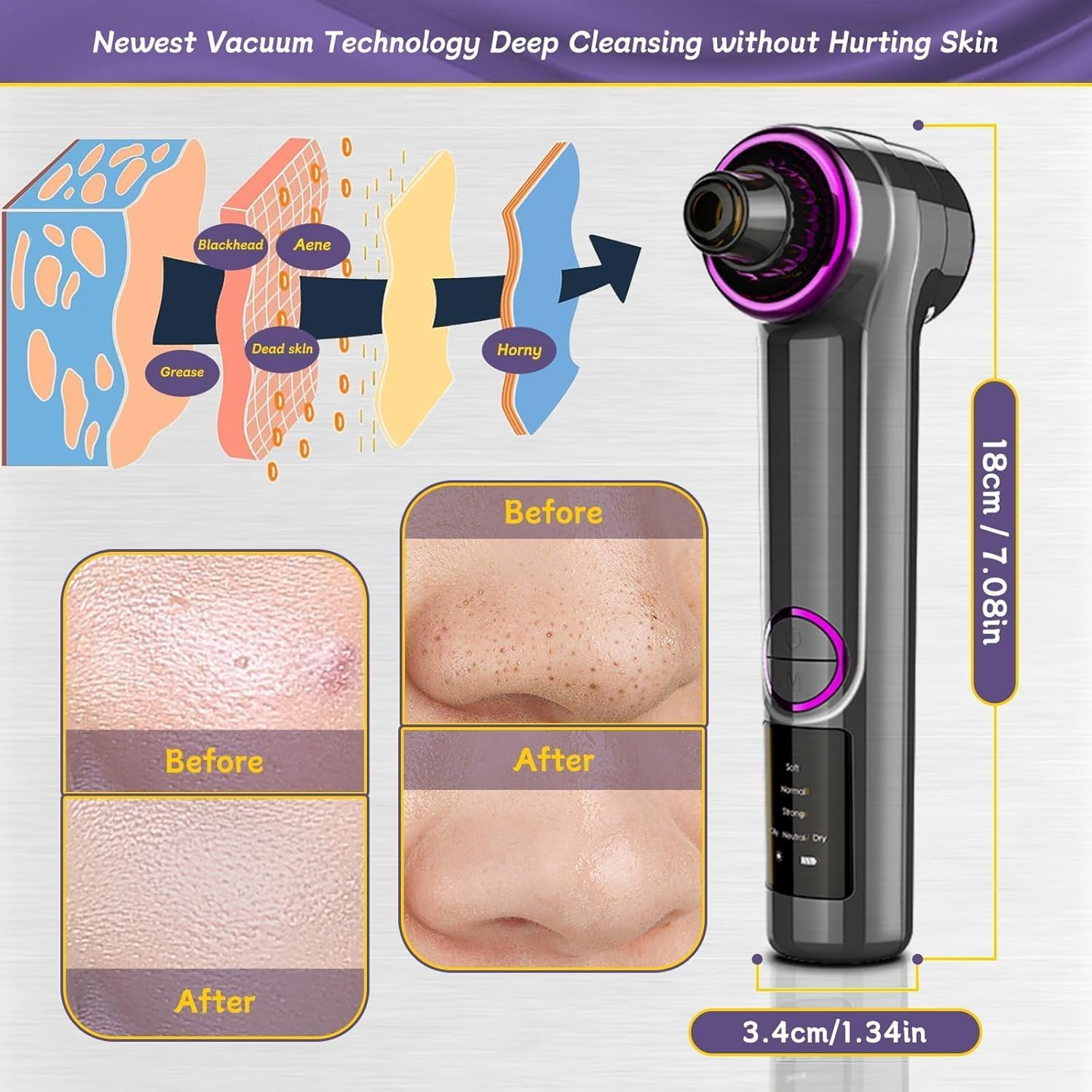 Blackhead Remover Vacuum, 2 in 1 Facial Pore Cleaner Electric, Vacuum Pore Cleansing Tool with Heating Mode, Electric Whitehead Remover with 5 Heads & 3 Suction Level, Comedone Extractor Kit image number 3