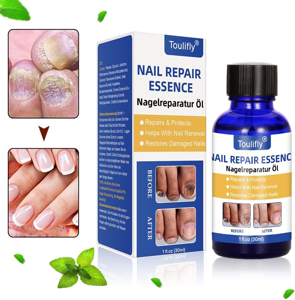 Nail Care and Treatment, Nail Care for Healthy Foot and Hand, Nail Care Oil, Nail Care image number 2