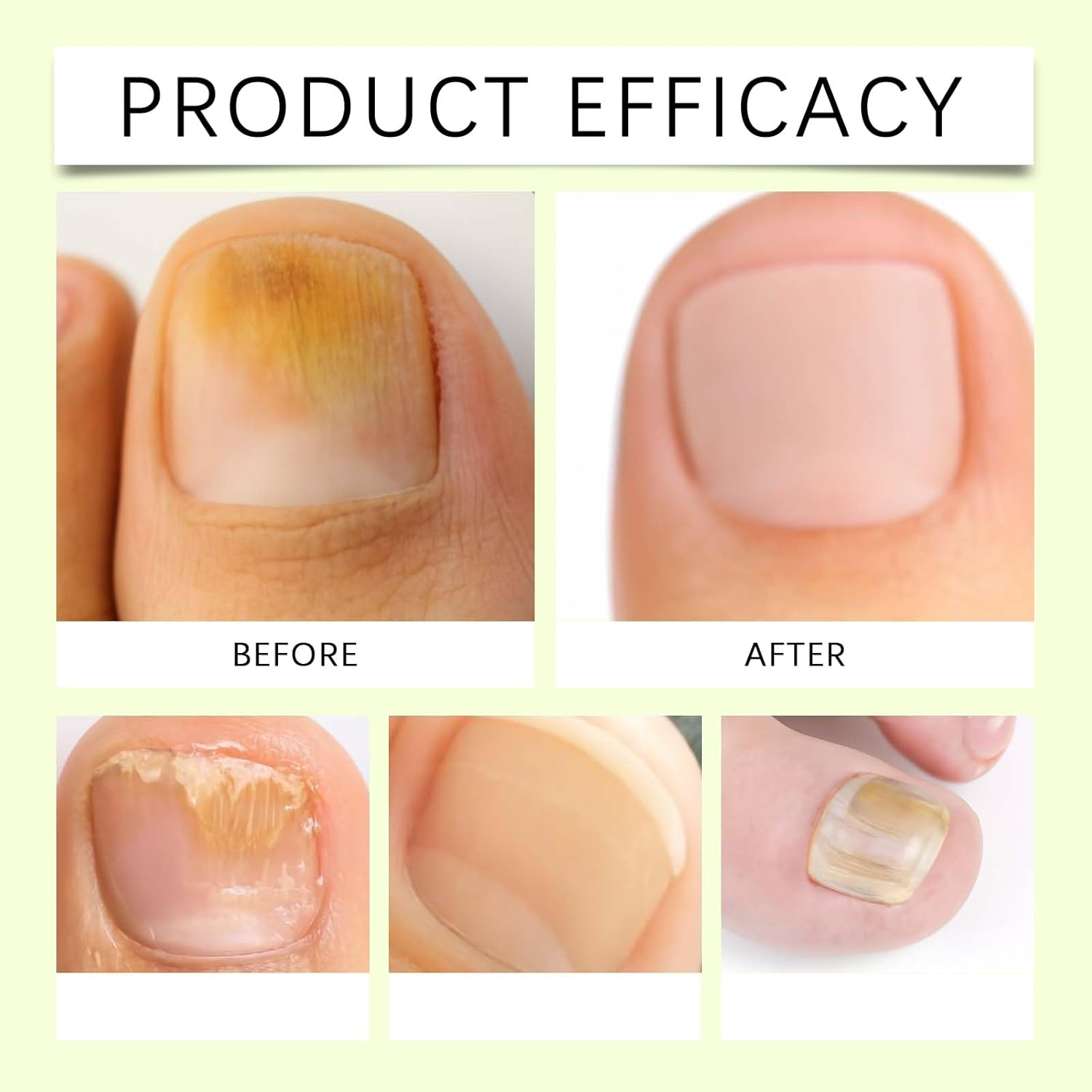 Ginger Nail Growth Serum 7 Days Nail Care Treatment Multi-Purpose Nails Repair Cream Ginger Cuticle Care Nourishing Oil Brittle Strengthener Suitable for Dry and Damaged (2Pcs) image number 2