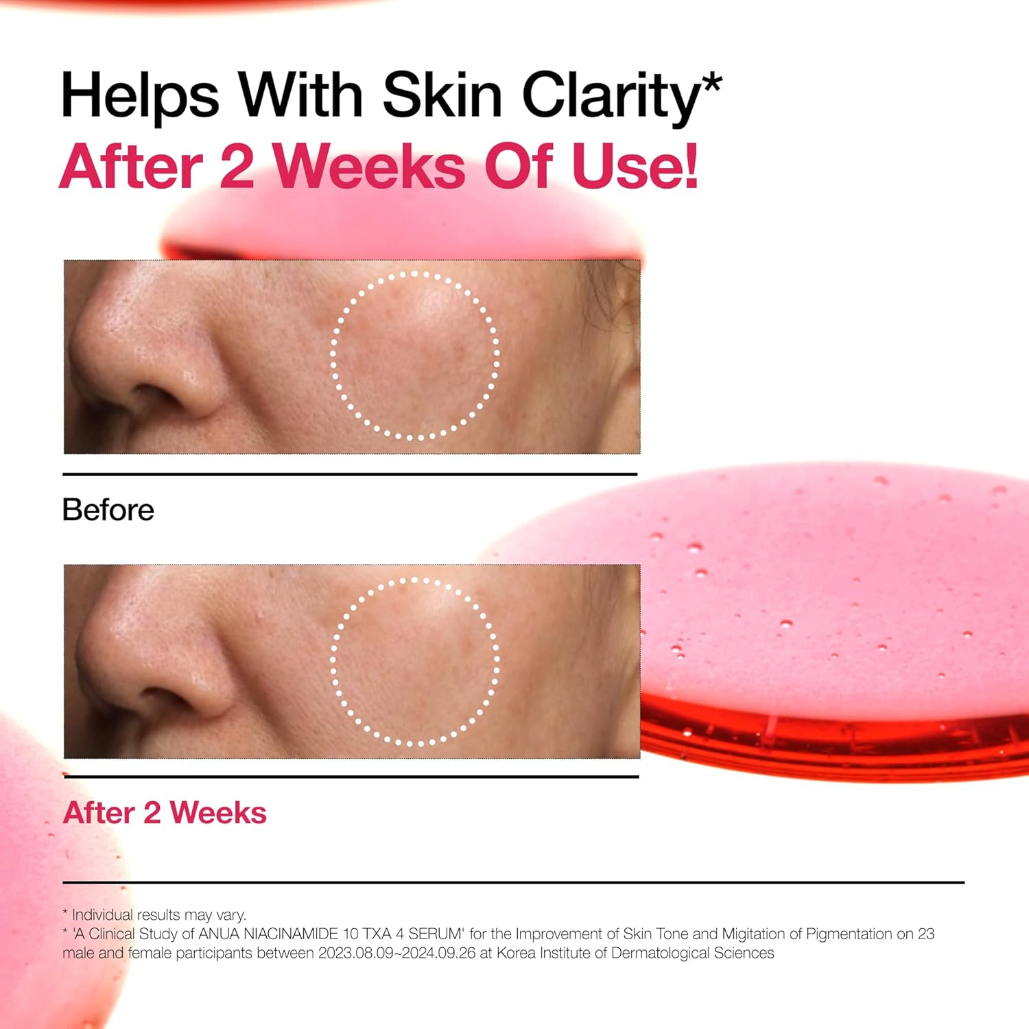 ANUA 10% Niacinamide+ 4% Tranexamic Acid Serum, Ceramide, Hyaluronic Acid, Vitamin B12 Natural Color, Korean Glass Skin, Fragrance-Free, Korean Skincare, 30Ml /1.01 Fl.Oz. image number 3