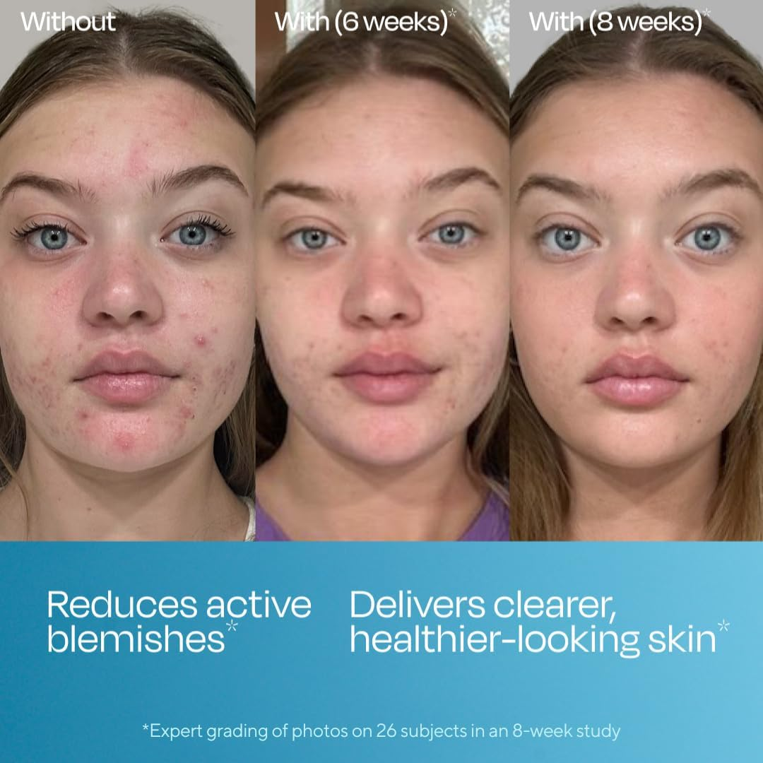 Murad Biome-Balancing Blemish Serum - Salicylic, Mandelic, Glutamic Acid - Helps Clear and Prevent Breakouts, Helps Clear Pores, Supports Skin Microbiome Balance - 30 Ml image number 6