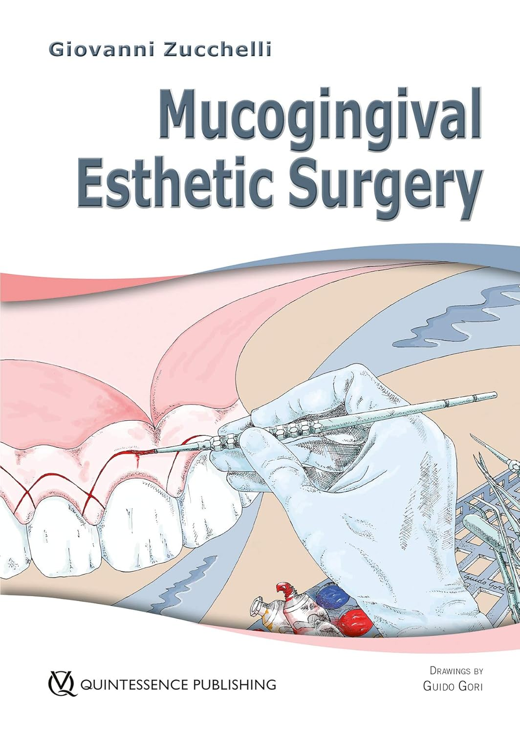 Mucogingival Esthetic Surgery