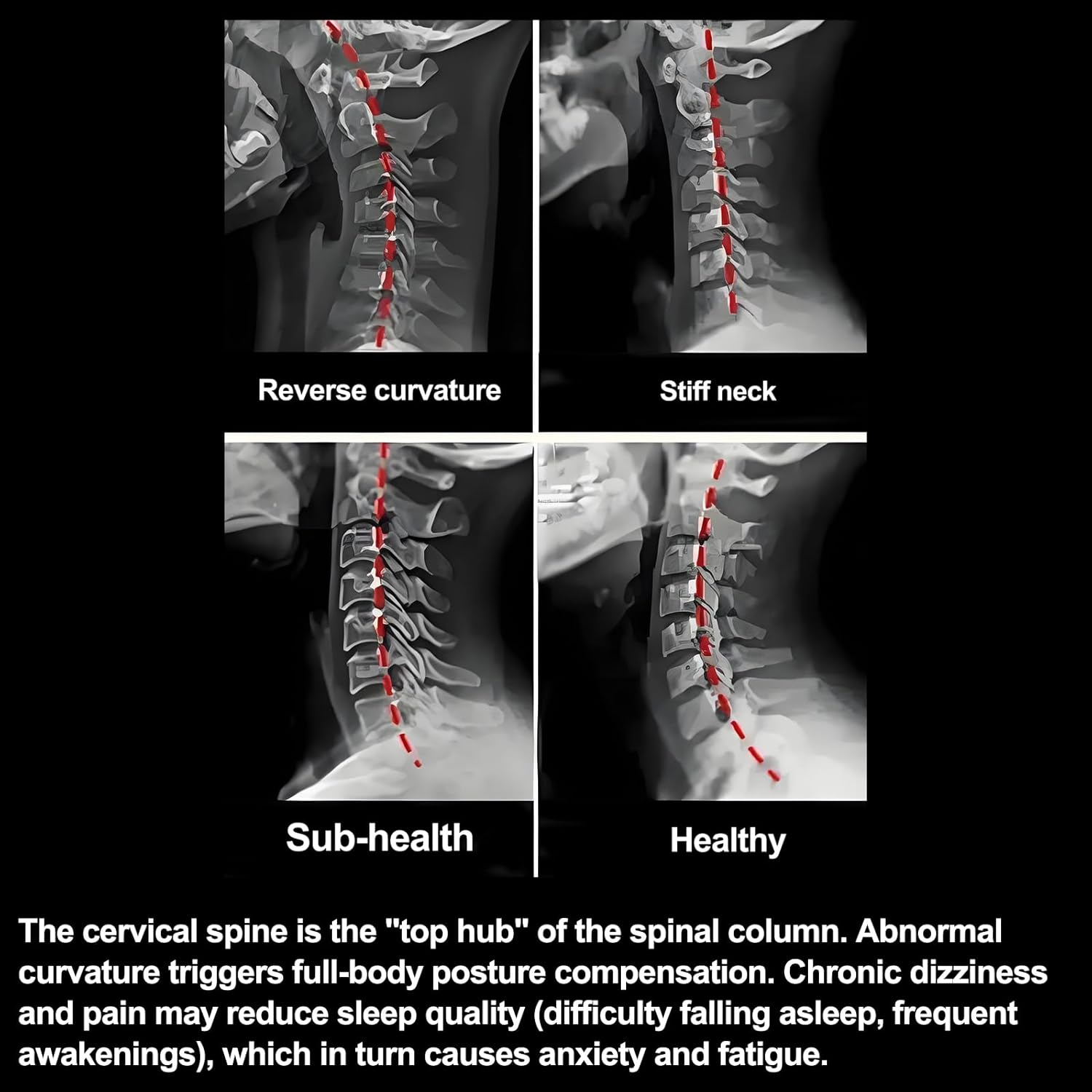 Cervical Neck Pillow for Pain Relief - Ergonomic Side Sleeper Pillow for Neck Support, Cooling Memory Foam Pillows for Sleeping, Contour Pillow Orthopedic Bed Pillow for Back Stomach Sleepers image number 6