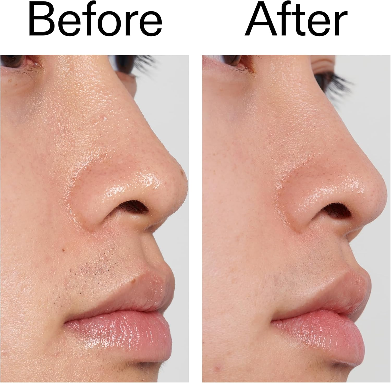 The Inkey List PHA Toner 100Ml | Locks in Moisture | Improves Skin Texture | Fragrance Free | Suitable for All Skin Types image number 5