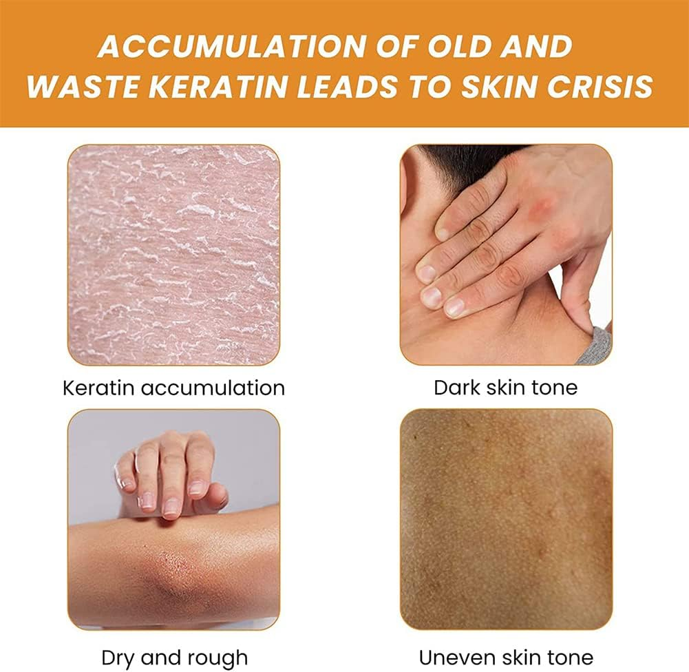 Gmeelan Orange Exfoliating Whitening Gel, Orange Exfoliating Gel Scrub Face Body Skin Whitening, Deep Cleaning Exfoliating Whitening Gel (3PCS) image number 6