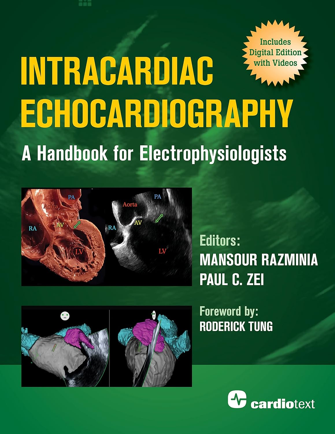 Intracardiac Echocardiography:: a Handbook for Electrophysiologists