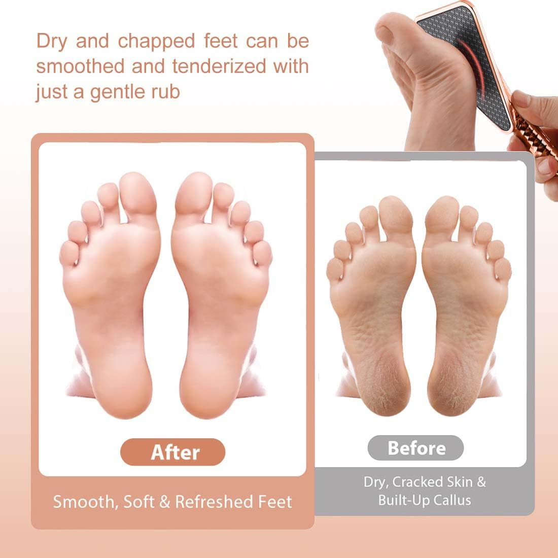 JYNVO 2-In-1 Nano Glass Callus Remover, Effective against Calluses, for Dry Feet, Velvety Soft Feet, Professional Foot Care Safe image number 4