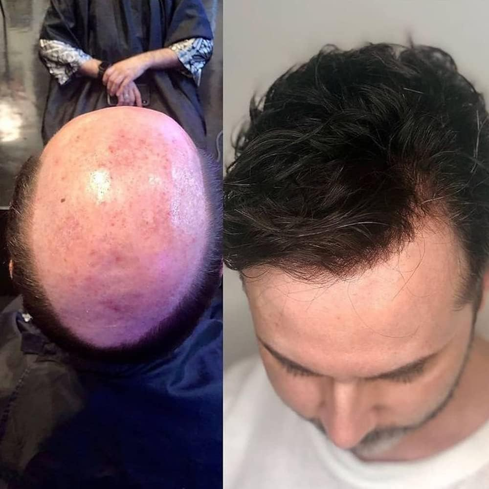 SIMBEAUTY Super Natural Hairline Human Hair Mens Toupee Free Style 10X8 Inch Thin Skin Hairpieces Replacement Systems Men Hair (0.06Mm Skin, 1B, off Black) - 20, Medium Dark Blonde image number 6