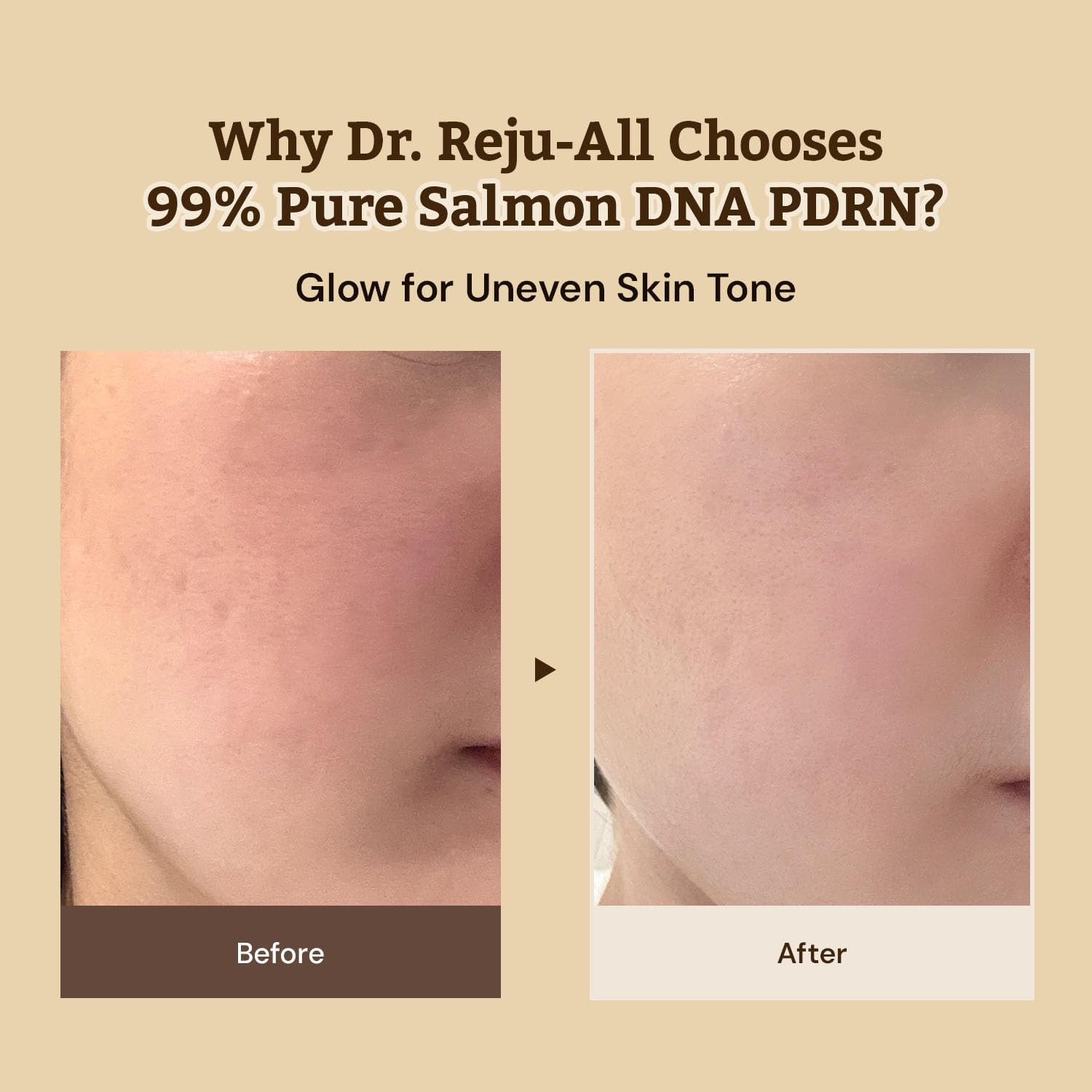 Dr. Reju-All Advanced PDRN Rejuvenating Cream - 99% Pure Salmon DNA PDRN Face Moisturizer - Korean Skin Care Face Cream - 20Ml image number 1