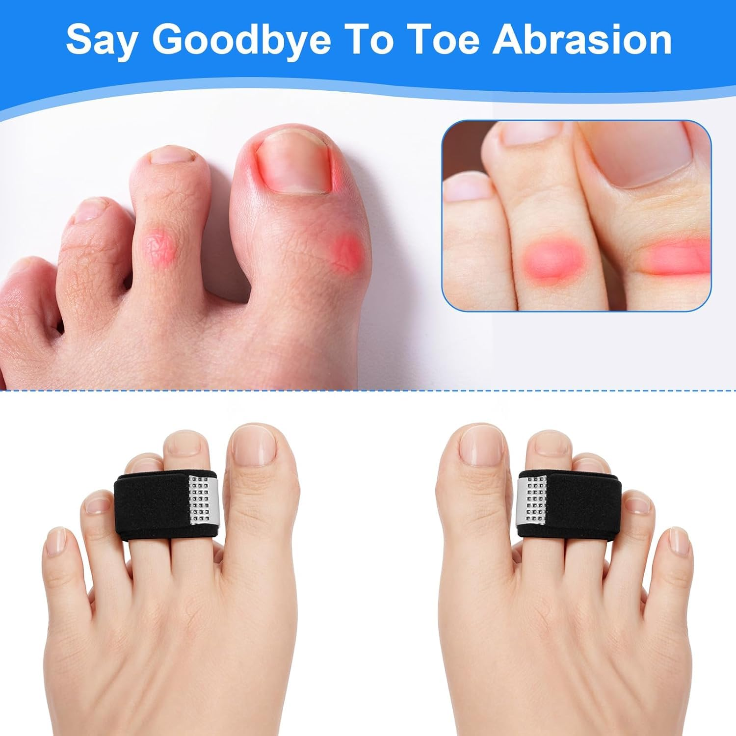 8 PCS Finger Splints Set with Adjustable Straps for Broken Toes, Sprained Fingers & Arthritis Pain Relief, Support & Protection for All Fingers image number 3