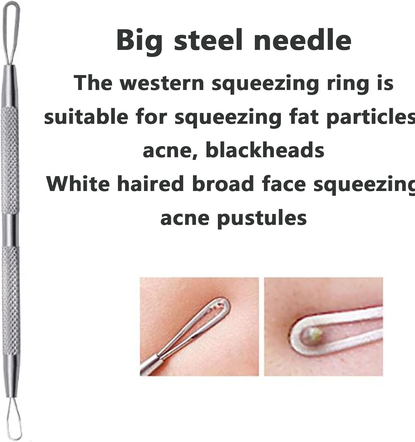 SYGELER Professional Stainless Steel Blackhead Remover Tool - Acne/Pimple Extractor Kit, Painless Blemish Removal for Face, Nose & T-Zone (2Pcs) image number 1